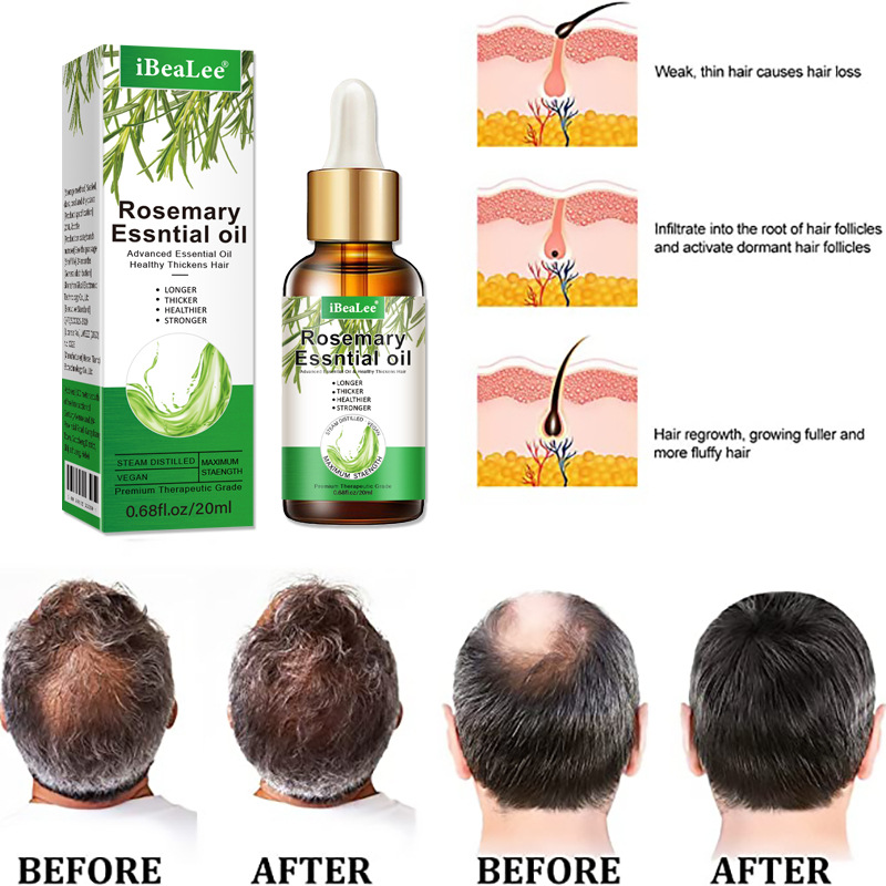 iBeaLee Rosemary Essential Oil for Hair Growth Reduce Hair Loss Hair Treatment Deeply Nourishing 20ml