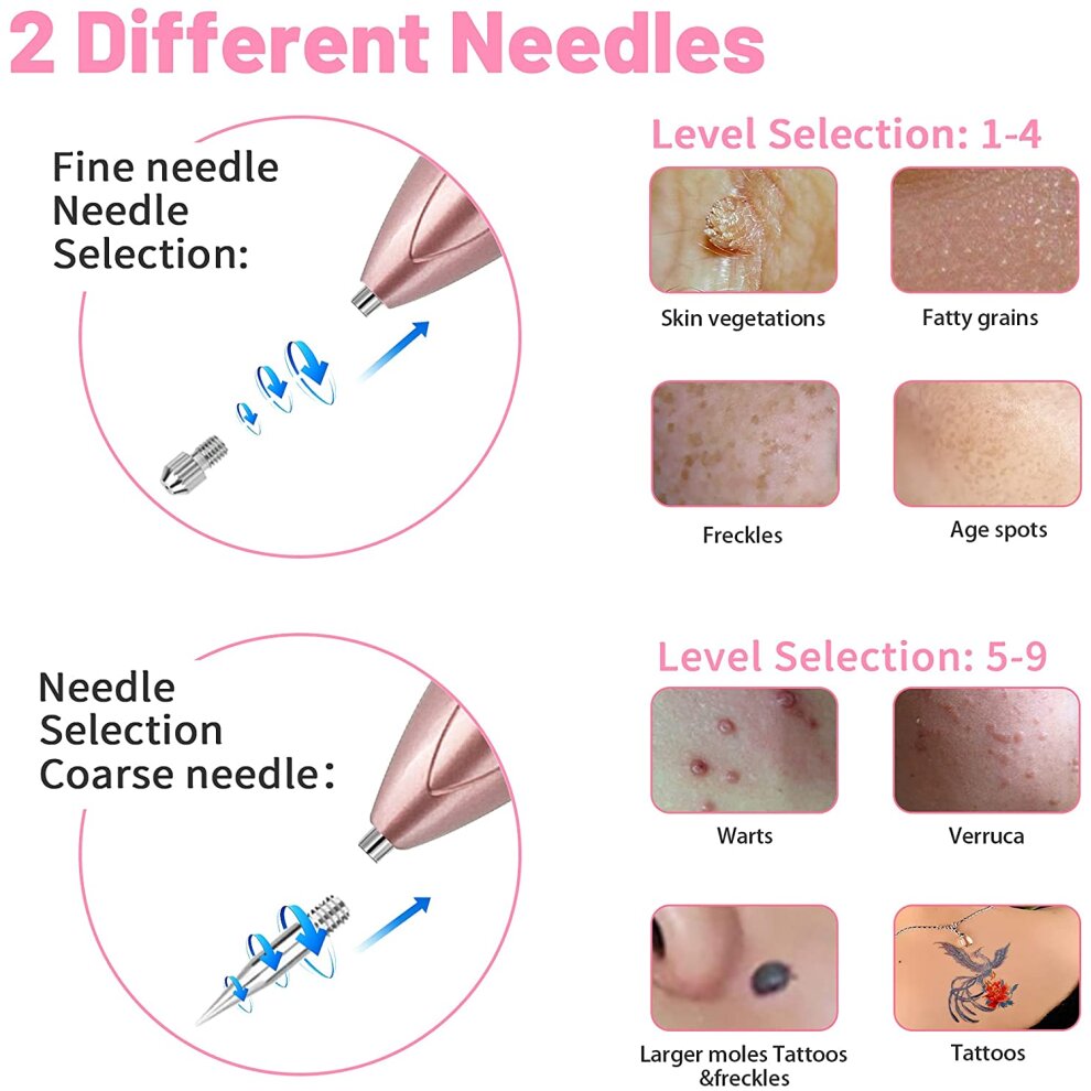 Mole Removal Pen for Freckle Watt Age Spots Nevus and Small Tattoo