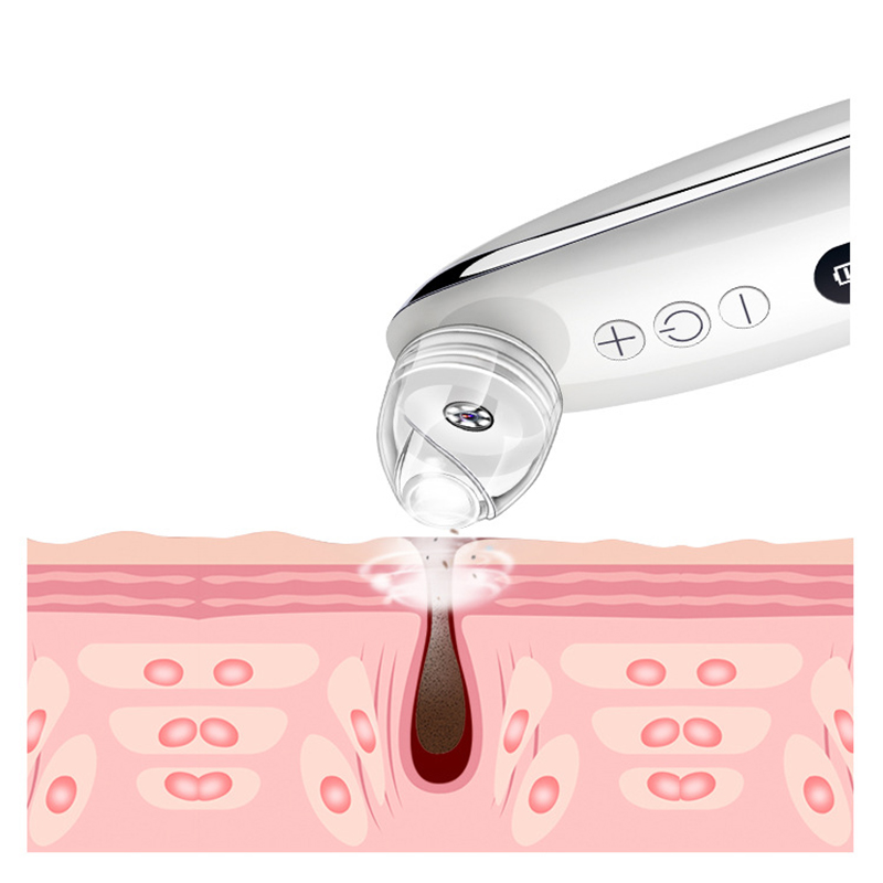 Blackhead Remover Vacuum Pore Cleaner Visual Blackhead Vacuum Kit Blackhead Suction Extractor Tool Skin Deep Cleaning Machine Charging Base HD Camera
