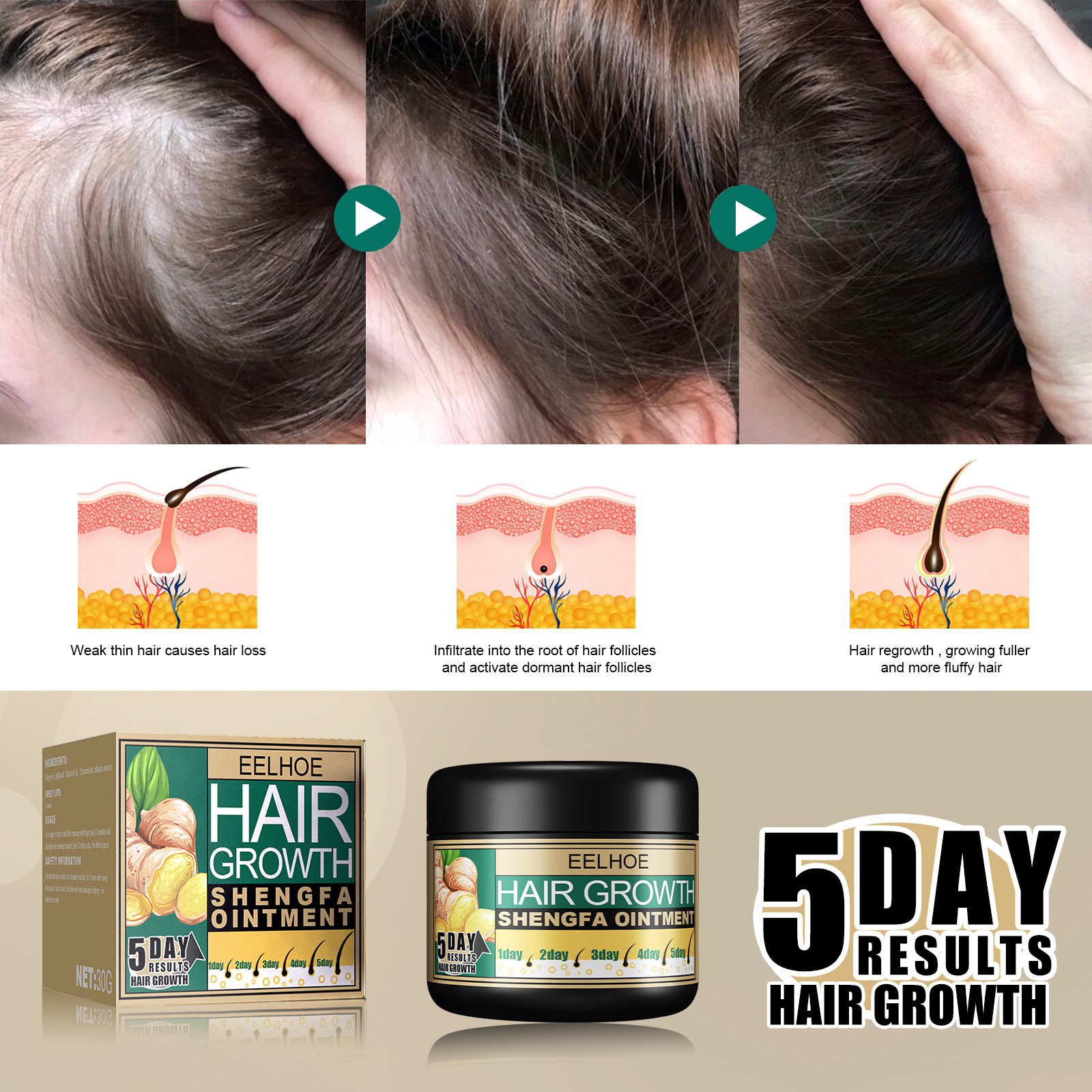 (30g) Ginger Hair Growth Ointment Hair Boost Cream Moisturising Scalp Massage Hair Care Essence Anti Hair Loss Conditioner Hair Thinning Treatment