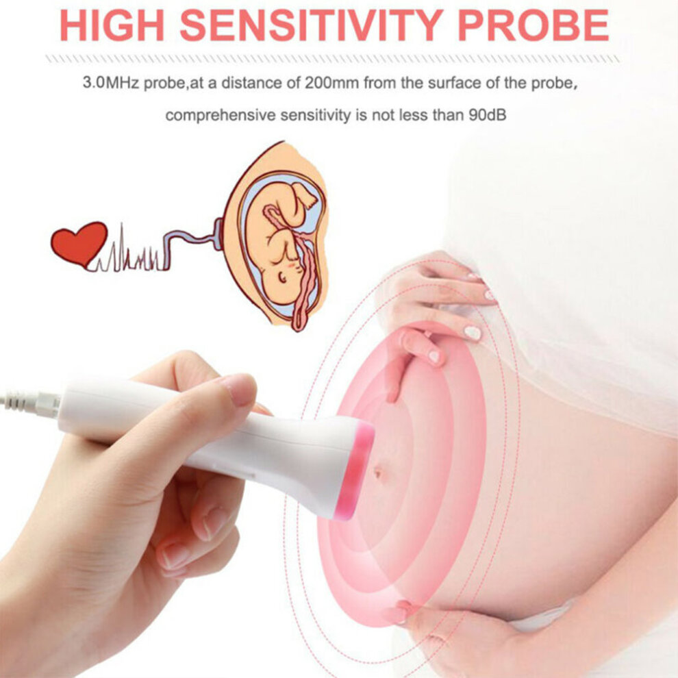 (Blue) Doppler Fetal Heart Rate Monitor Baby Heartbeat Monitor Pregnancy Home Baby Heartbeat Monitor Pregnancy