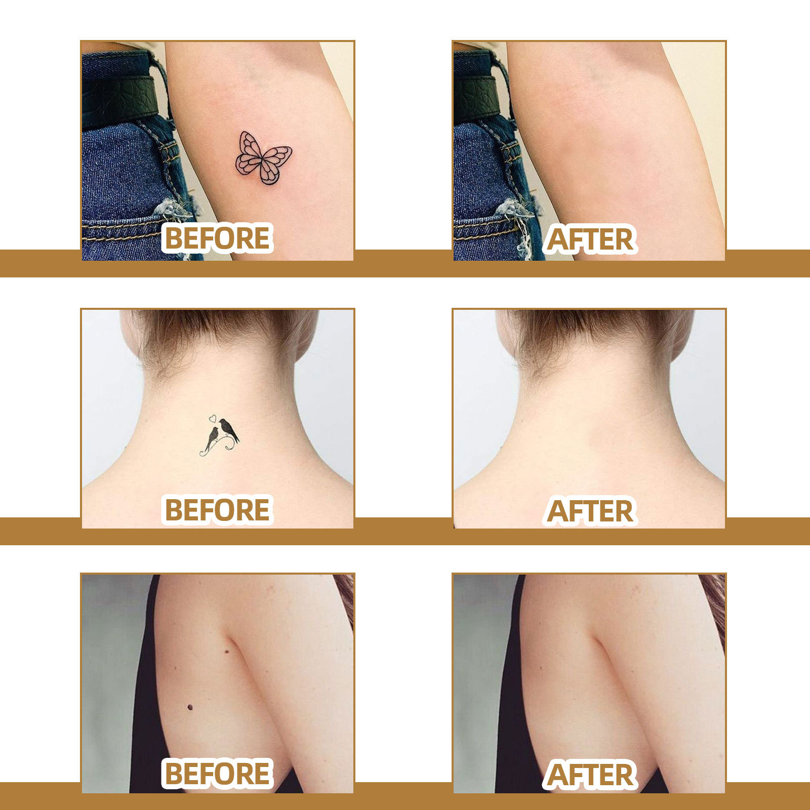Jaysuing Tattoo Cover Up Skin Color Scar Concealer Sticker Portable Flaw Birthmark Concealing Waterproof Beauty Cosmetic Tools