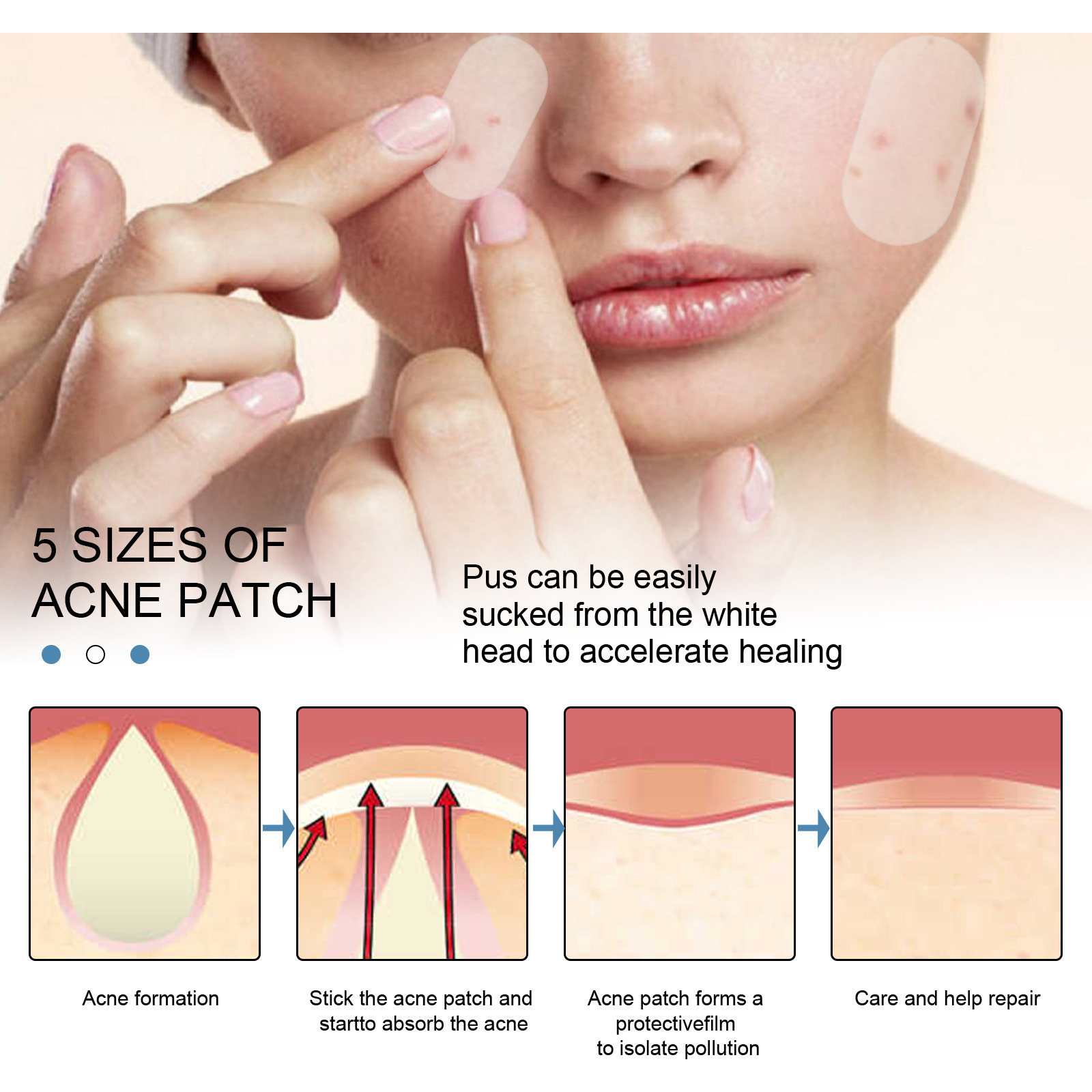 80Pcs Large Size Acne Patches Removal Pimple Anti Acne Hydrocolloid Bandage Patches Spots Marks Concealer Repair Sticker Skin Blemish Remover Skin Care