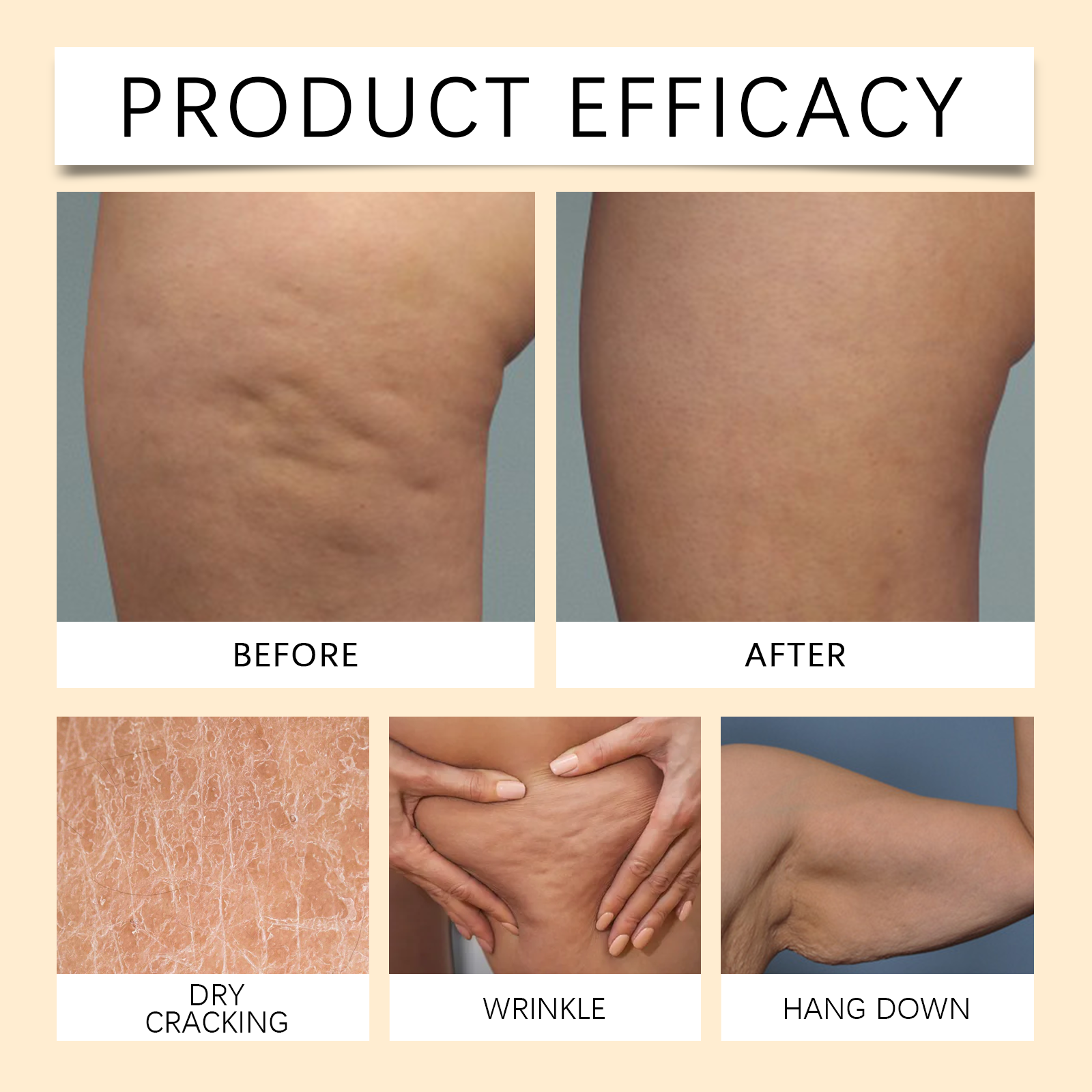 Bee Venom Care Cream Mild Ingredients Nourish Skin Lock Skin Moisture Soften Skin Daily Body Care
