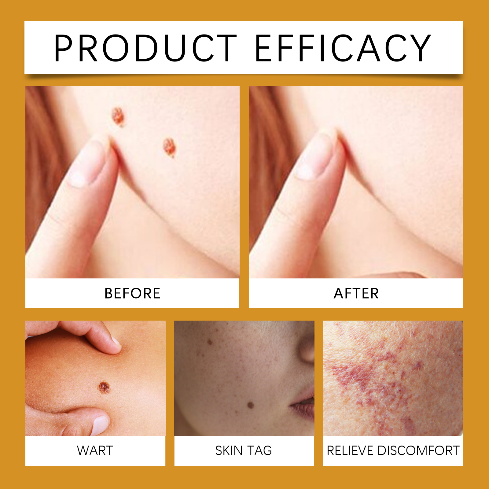 Bee Venom Care Cream Daily Protect Soothe Redness Remove Blemish Easy Spread Boost Skin Smooth Texture