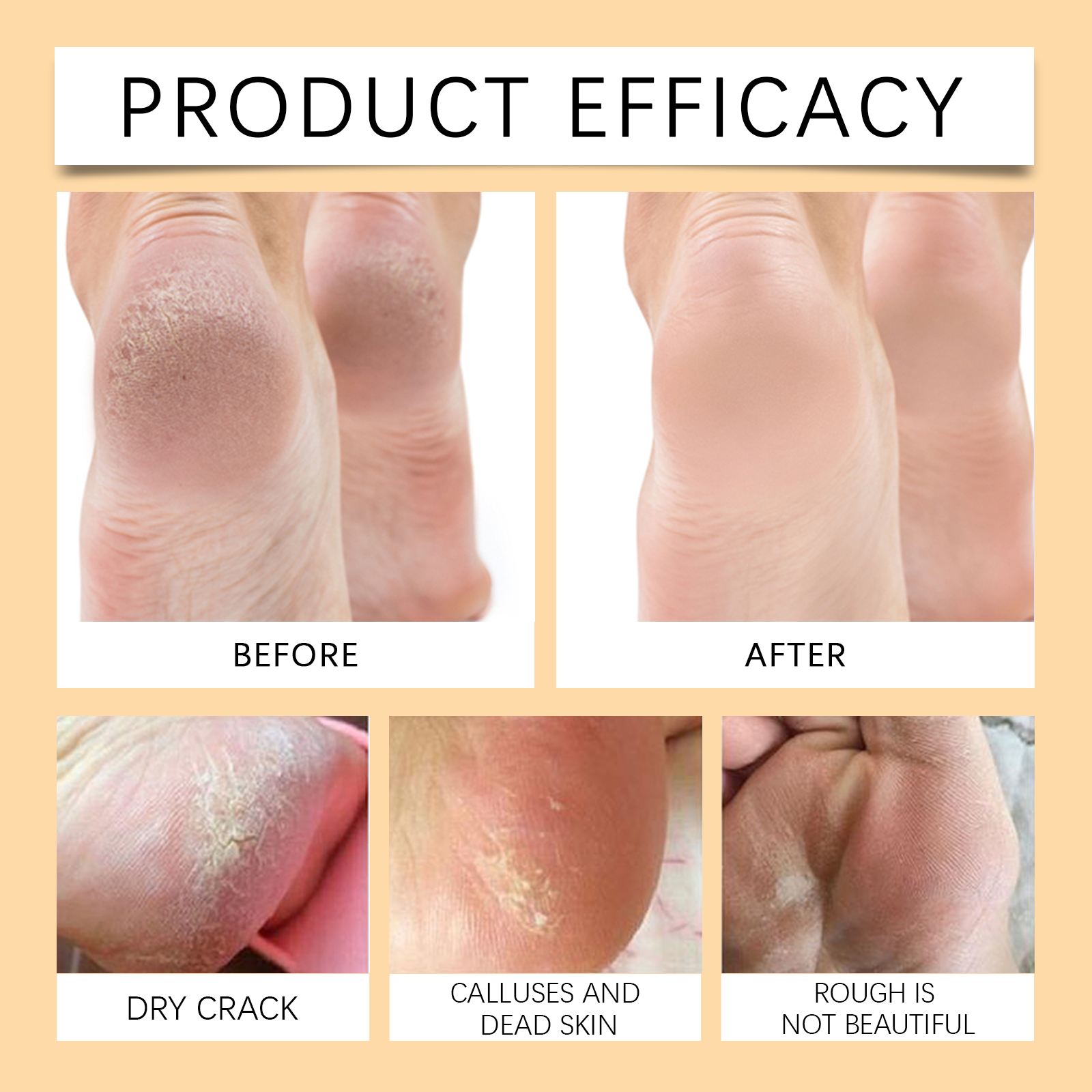 Vitamin C Turmeric Peel Off Hand Foot Mask Gentle Clean Dead Skin Moisturize Nourish Soften