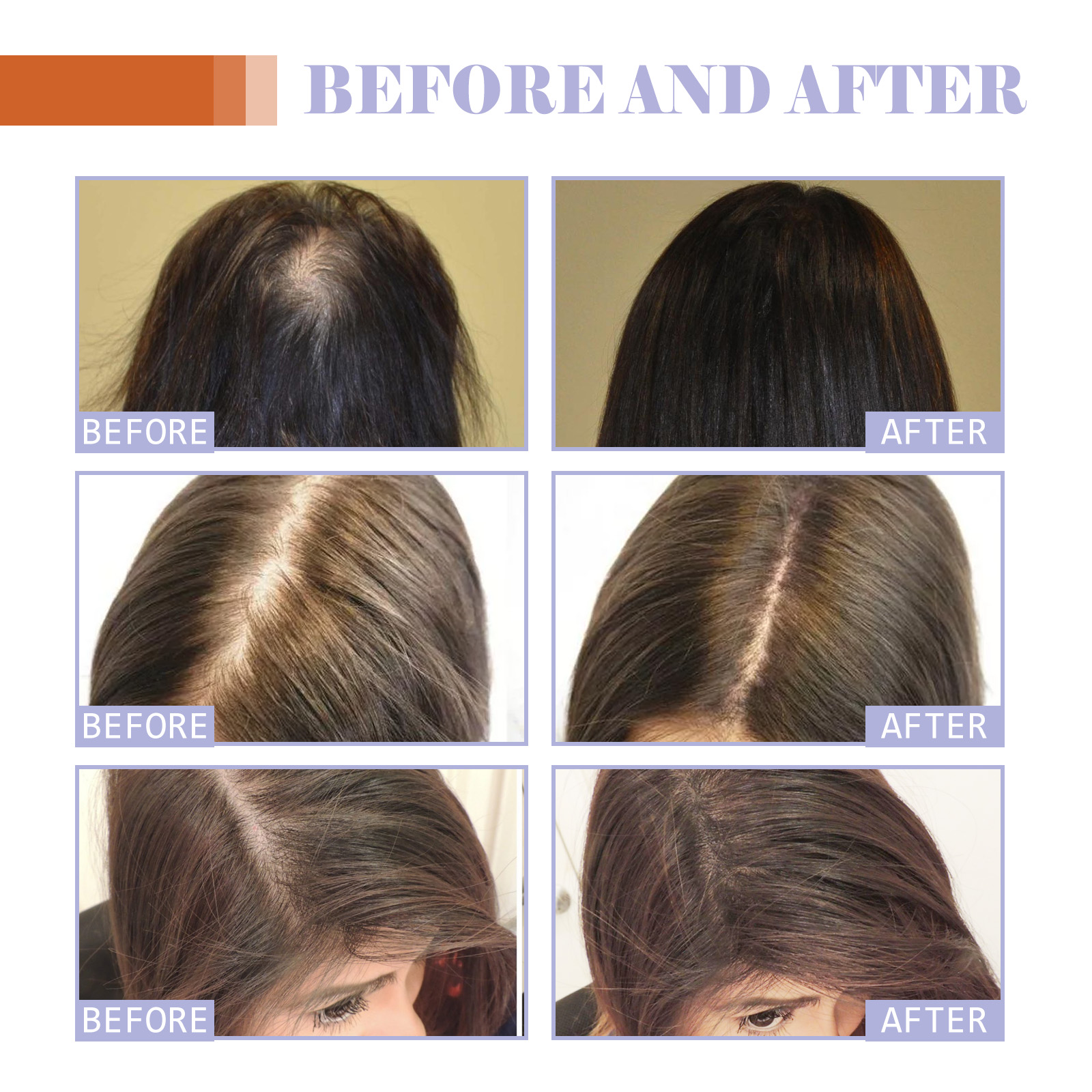 Hair Thickening Supplement Oral Drops Scalp Nourishing For Healthier Fuller Looking Hair Daily Care