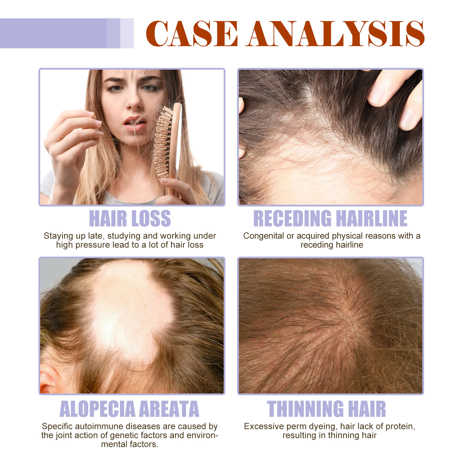 Hair Thickening Supplement Oral Drops Scalp Nourishing For Healthier Fuller Looking Hair Daily Care