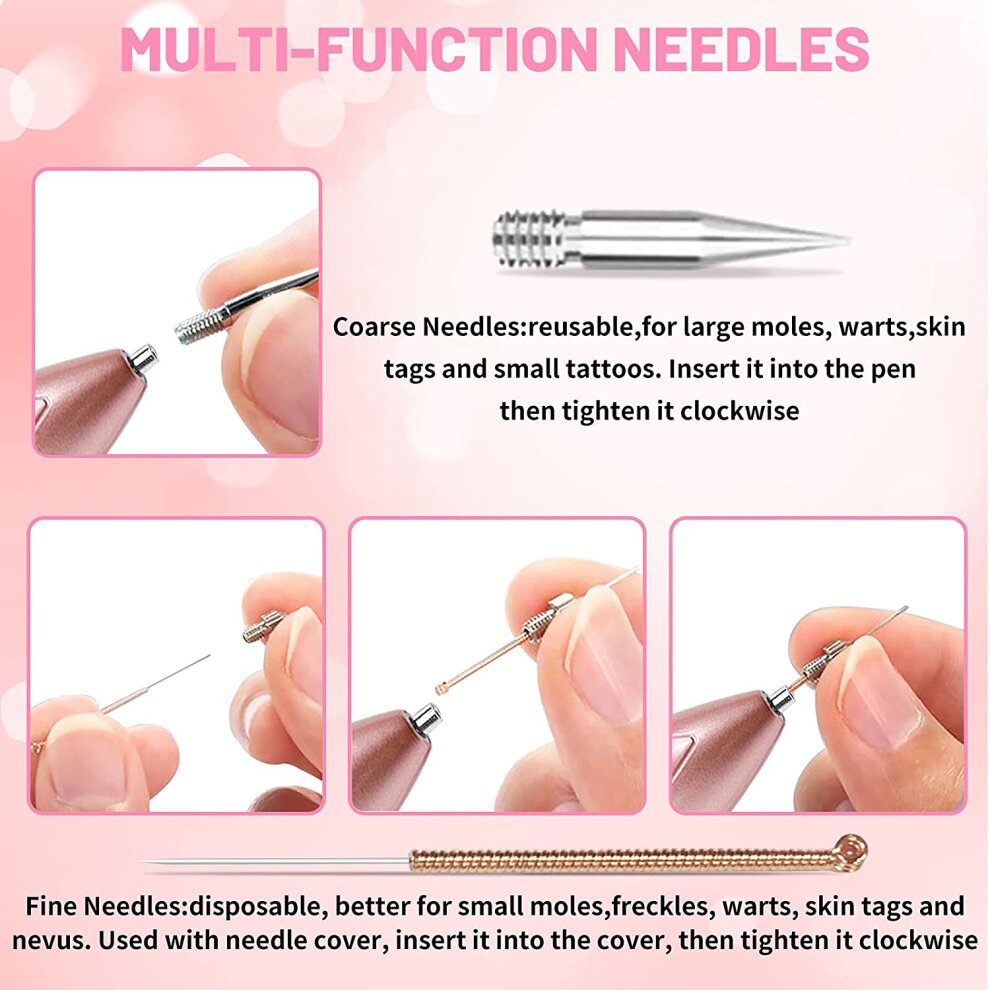 Mole Removal Pen for Freckle Watt Age Spots Nevus and Small Tattoo