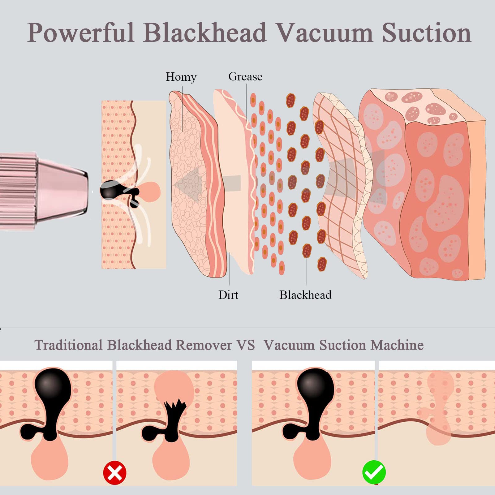 Blackhead Remover Vacuum Blackhead Extractor Face Pore Cleaner