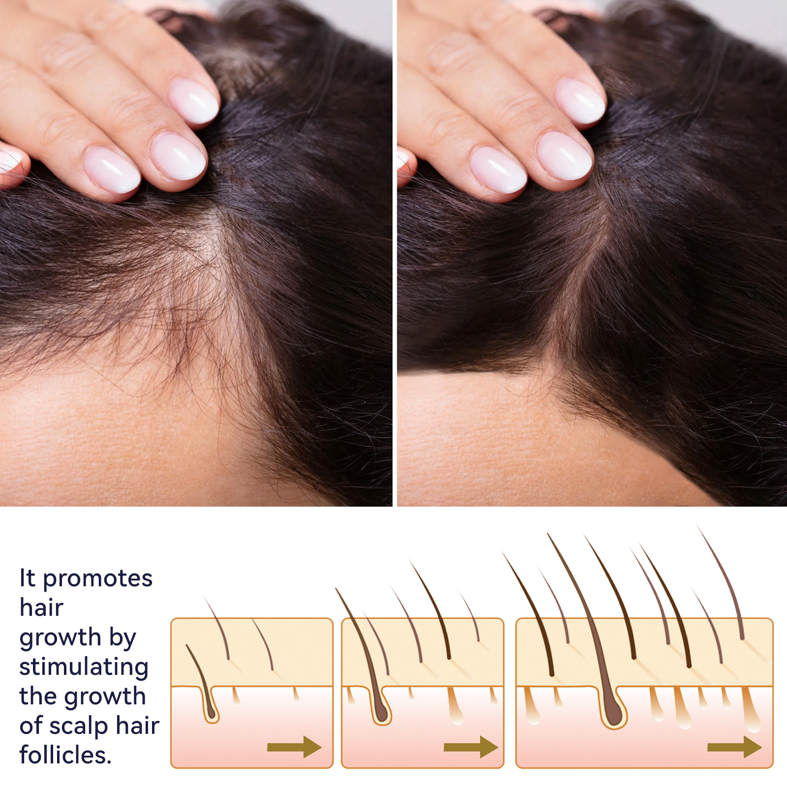 Hair Lotion Serum Essence Oil Hair Applicator Hair Growth Treatment Hair Anti Hair Loss Spray Stripping and Repairing Damaged Hair Roots for Men Women