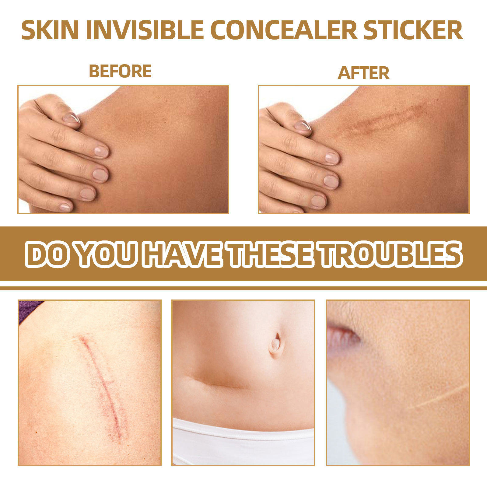 Jaysuing Tattoo Cover Up Skin Color Scar Concealer Sticker Portable Flaw Birthmark Concealing Waterproof Beauty Cosmetic Tools