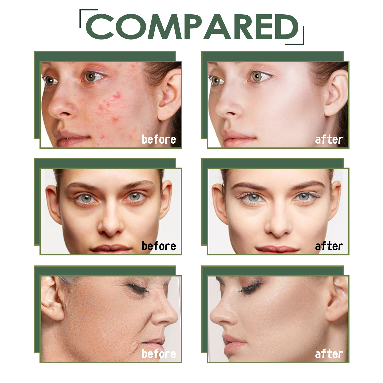 Pore Shrinking Facial Serum Licorice Root Extract Essential Oil Reduces Acne Wrinkle Essence Control Blackhead Desalinate Stain Remove Liquid Face Care 30ml
