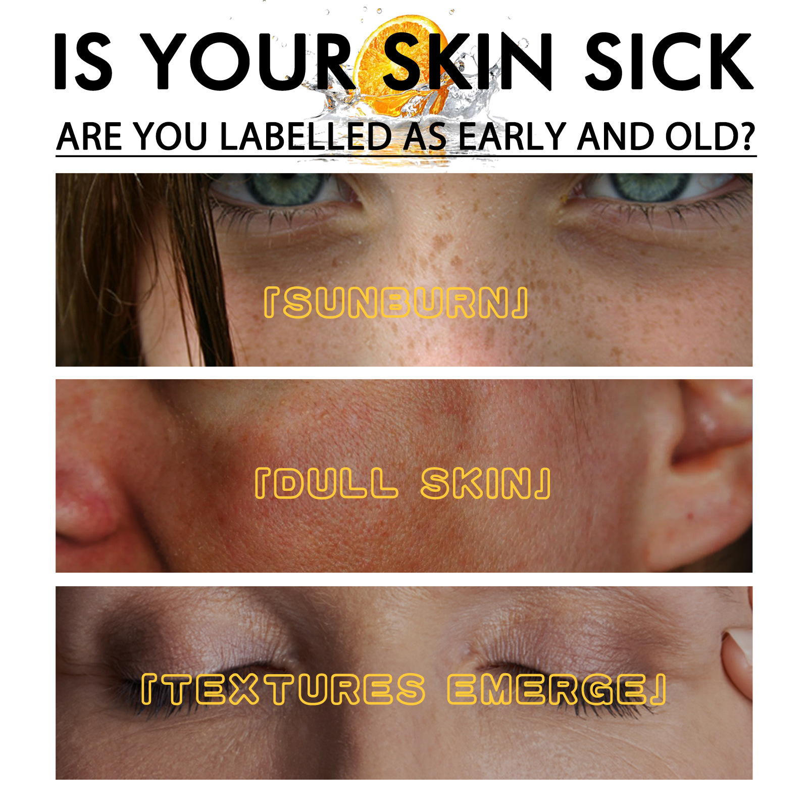 Vitamin C Whitening Freckles Serum Face Essence Remove Dark Spots Freckles Fade Melanin Nicotinamide Essence Brighten Lighten Moisturizing Facial Serum