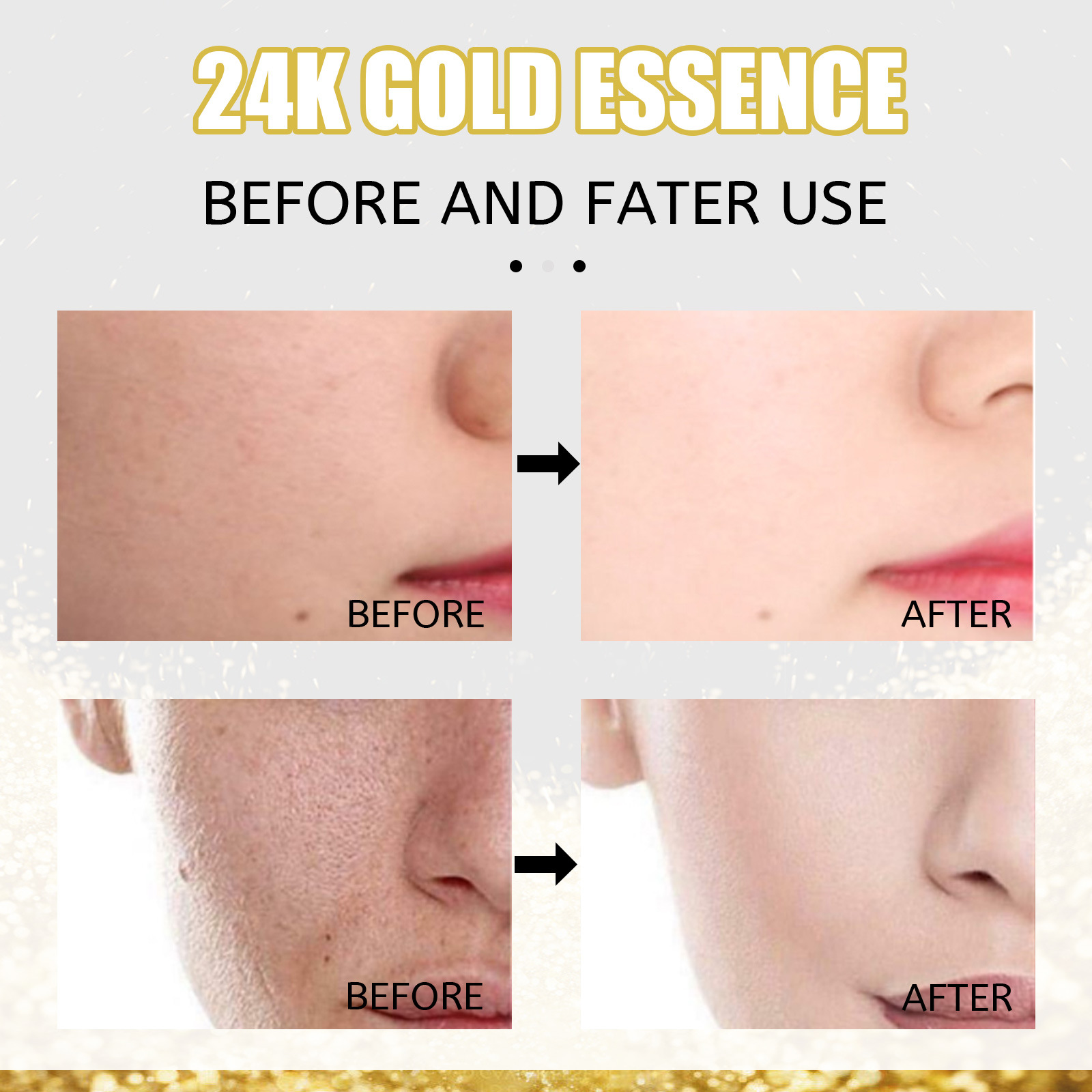 (1 PC) OUHOE 24k Gold Face Serum Moisturizing Brighten Skin Tightening Whitening Rejuvenate the Face Shrink Pores Nicotinamide Facial Serum Anti Aging Essence