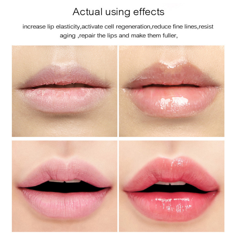 Abundant Lip Jelly Oil Moisturizing Nourishing For Dry Chapped Lips Daily Hydrating Essential Care 17ml