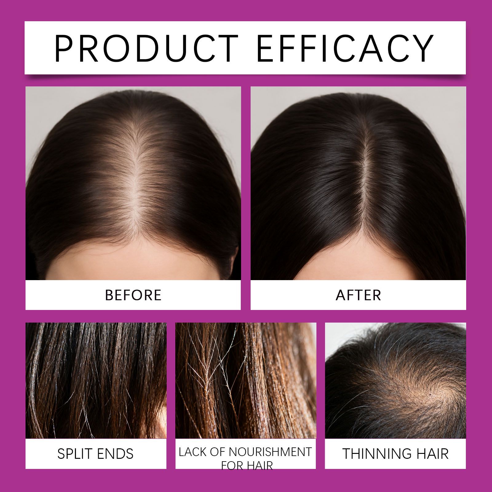 Hair Care Gummies With Biotin And Vitamin C Daily Chewable Supplement For Hair Wellness