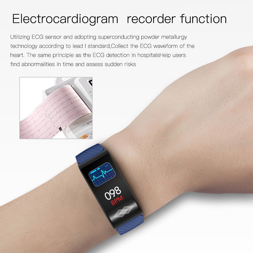 (Blue) 24-hour Dynamic ECG Monitoring Smart Tracker Super Precision Lorentz Diagram Smart Watch For Men Women