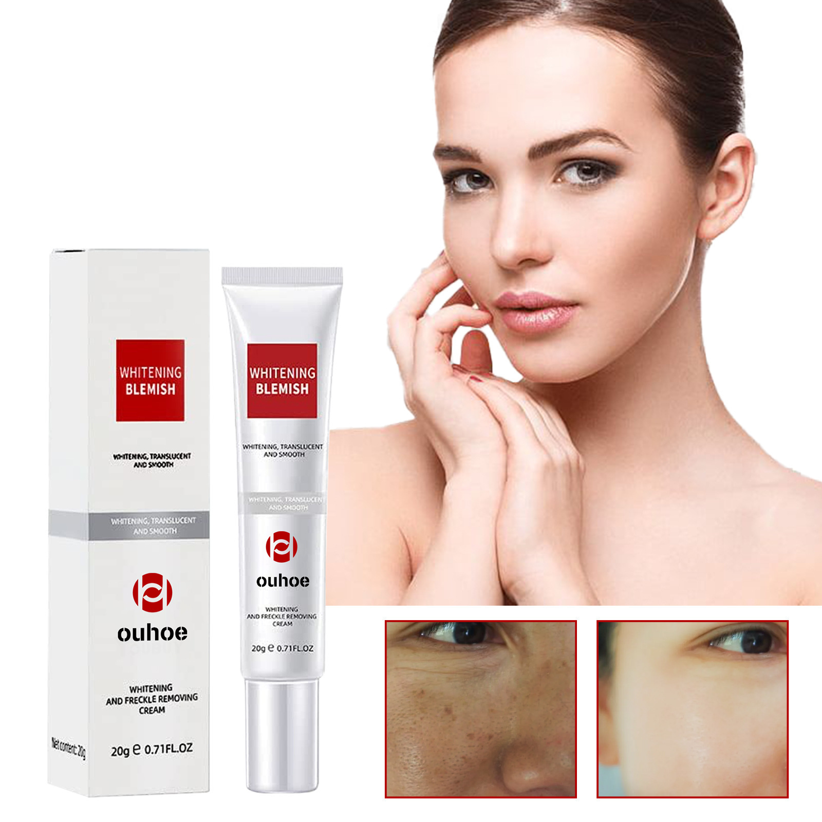 Whitening and Freckle Removing Cream Remove  Dark Spot Melanin Melasma Lighten Brighten Smooth Skin Care
