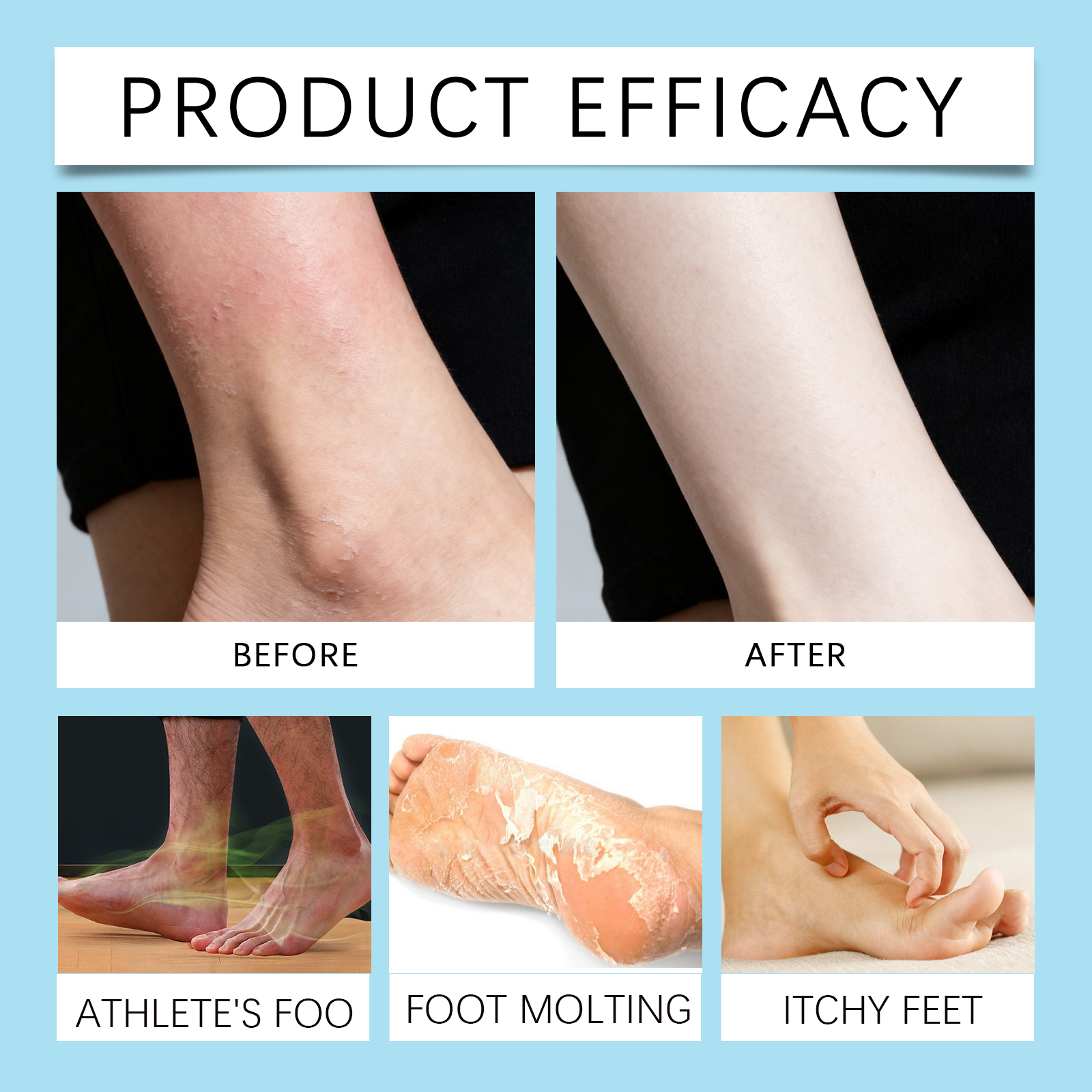 Refreshing Care Spray Gentle Daily Foot Skin Care Dry Comfort Non Sticky Portable Carry Spray