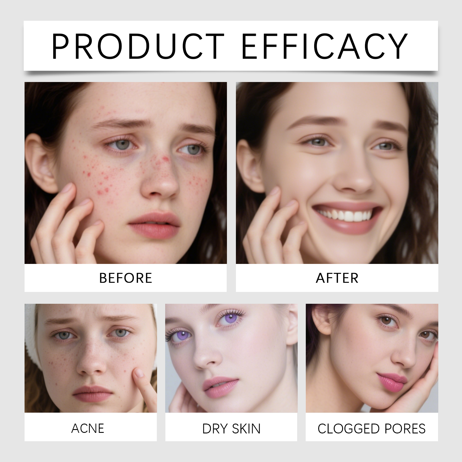 Facial Acne Essence Liquid Mild Cleansing Skin Moisturizing Refreshing Non Greasy Acne Care