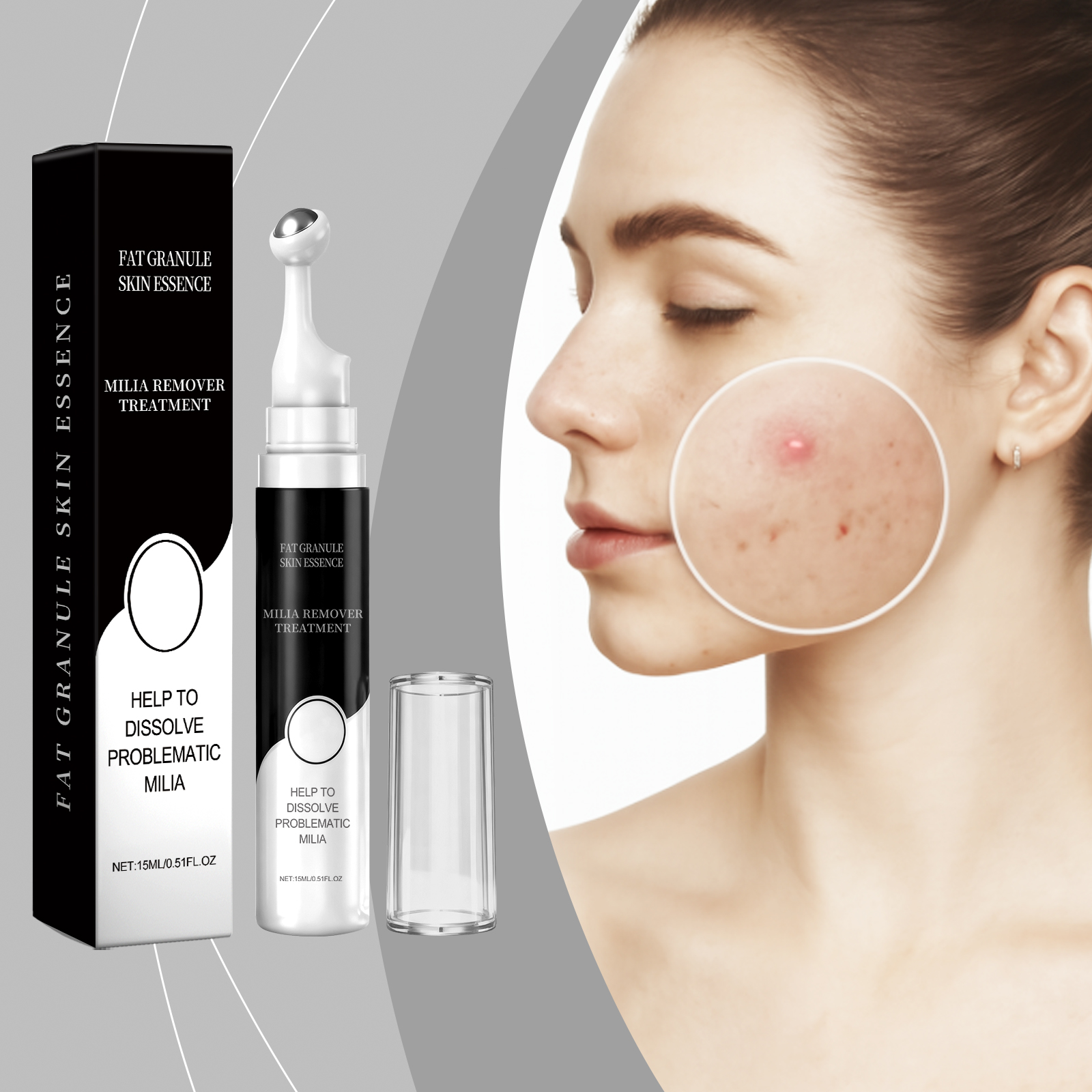 Facial Acne Essence Liquid Mild Cleansing Skin Moisturizing Refreshing Non Greasy Acne Care