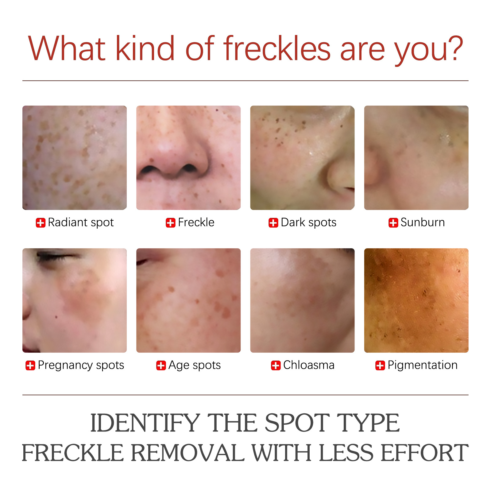 Pigment Correcting Cream Face Pigment Spots Moisturizer Black Spot Blemish Remover Hydrating Skin Care