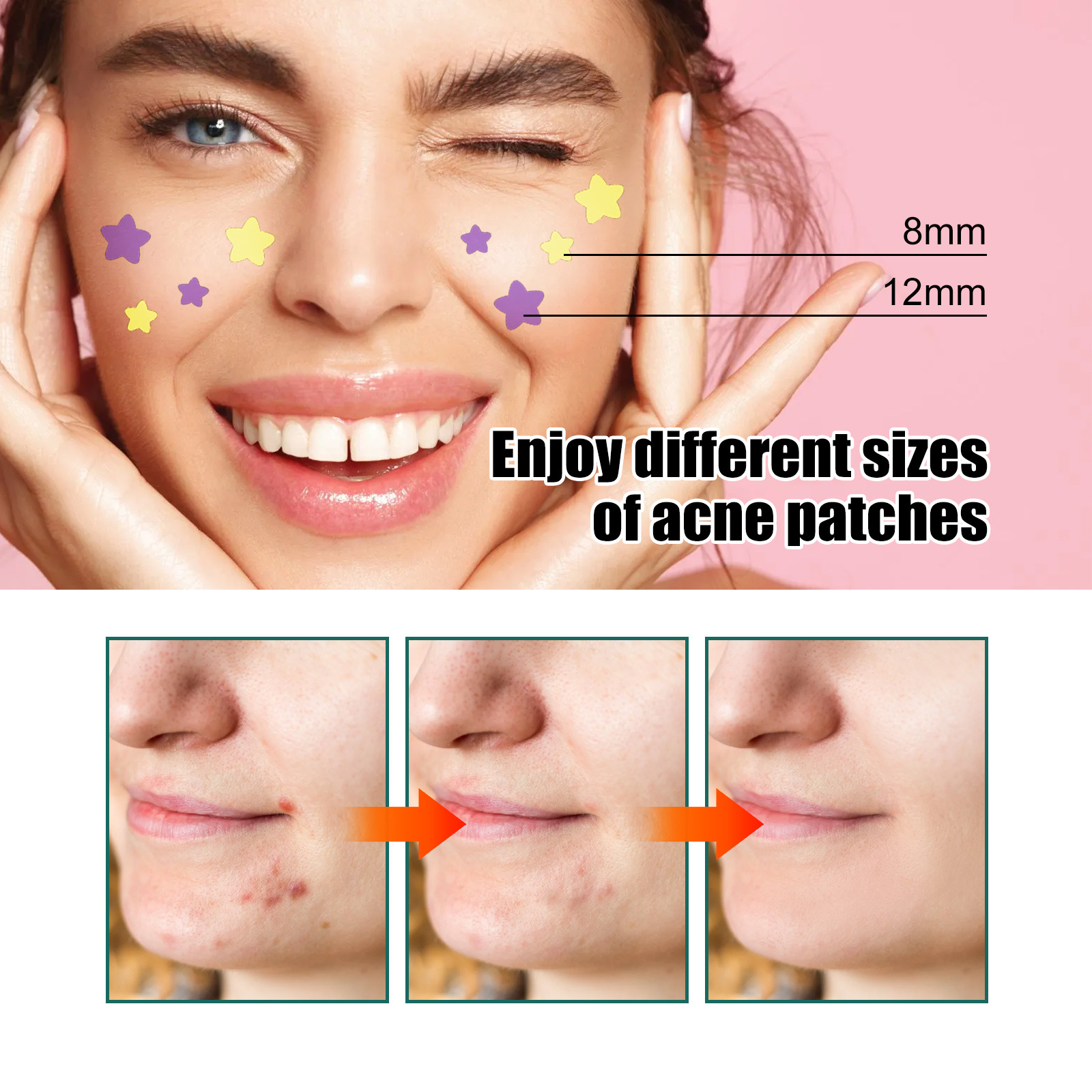 EELHOE Mini Cute Star-shaped Invisible Acne Removal Pimple Patch Beauty Acne Tools Face Spot Beauty Makeup