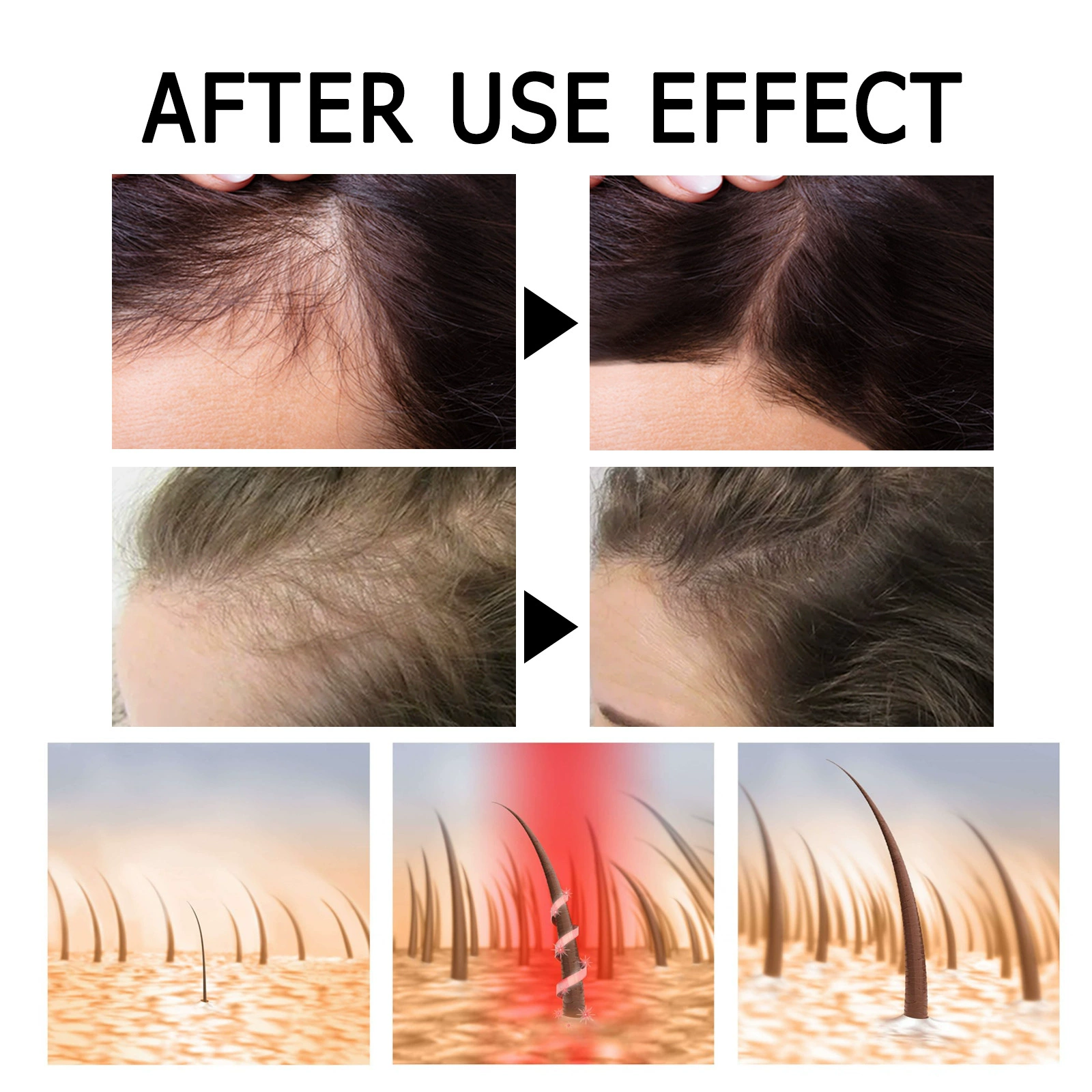 Fast Hair Regrowth Serum Repairing Nourish Follicles Anti Hair Thinning Serum
