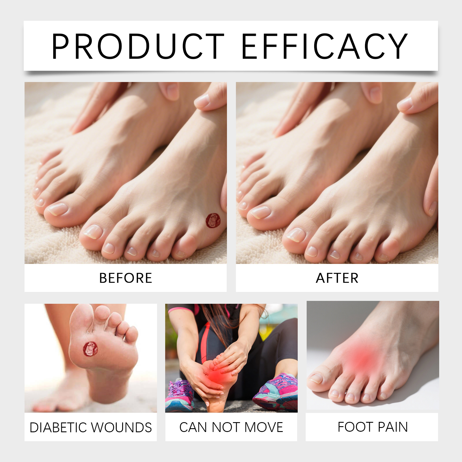 Herbal Foot Care Spray Refreshes Skin Eliminates Odor Keeps Dry Smooth Moisturizes Hydrates Softens Tired Feet