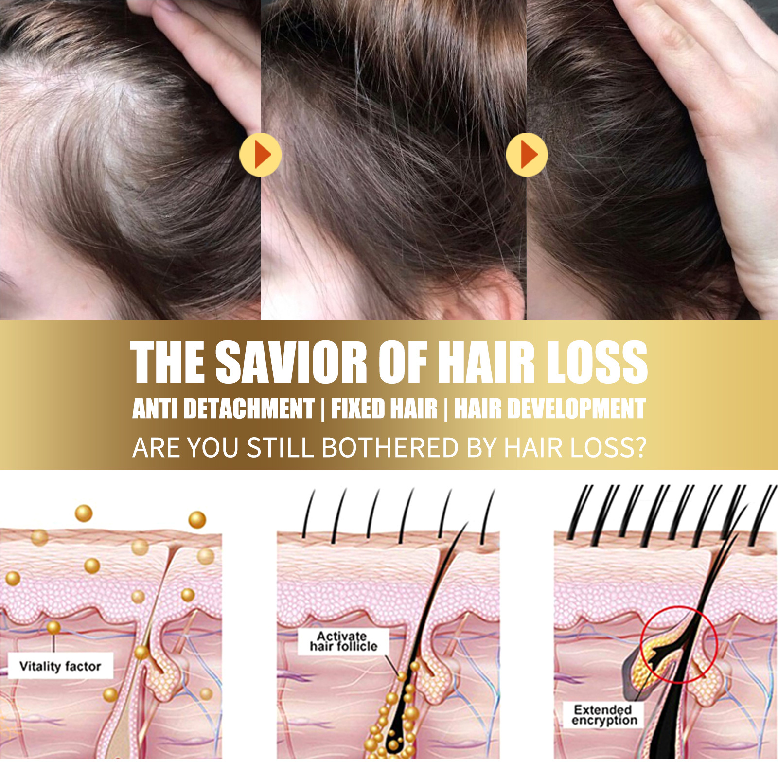 Hair Scrub Hair Exfoliating Scrub Cleaning Dandruff Fluffy Moisturizing Firming Scalp Care Hair Care Promotes Hair Growth Exfoliatings Scalp Scrubber