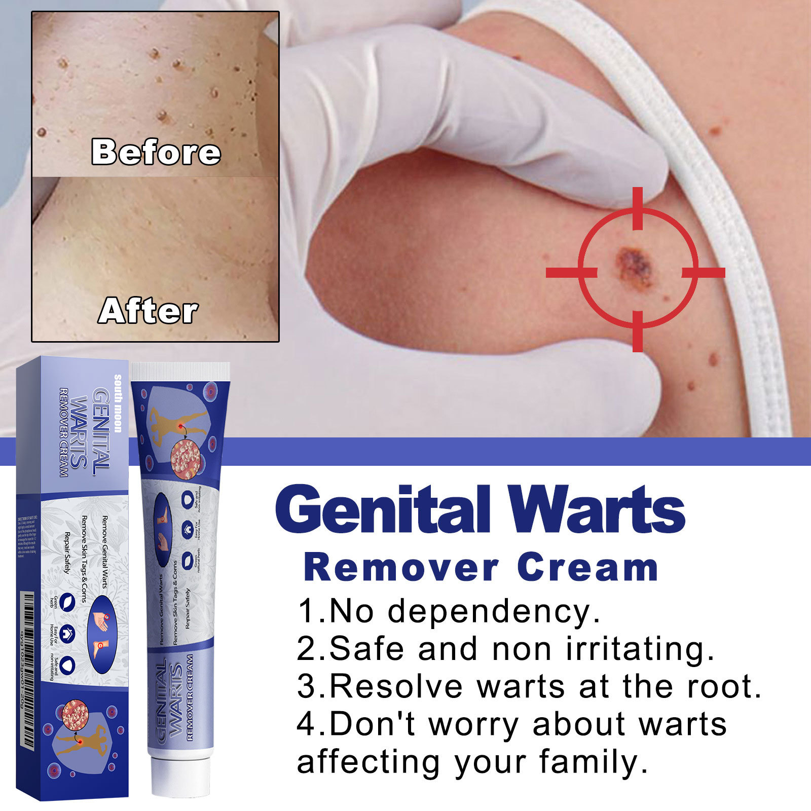 South Moon Skin Tag Remover Liquid Kit Wart and Tag Remover Wart Remover Fast Acting and Painless  for Body Anti Acne Face Cream Natural Safe Mole Remover