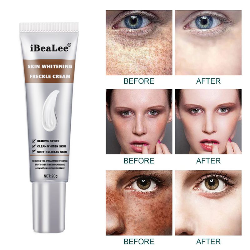 iBeaLee Skin Whitening Freckle Cream Melanin Fade Brighten Lightening Skin Care Facial