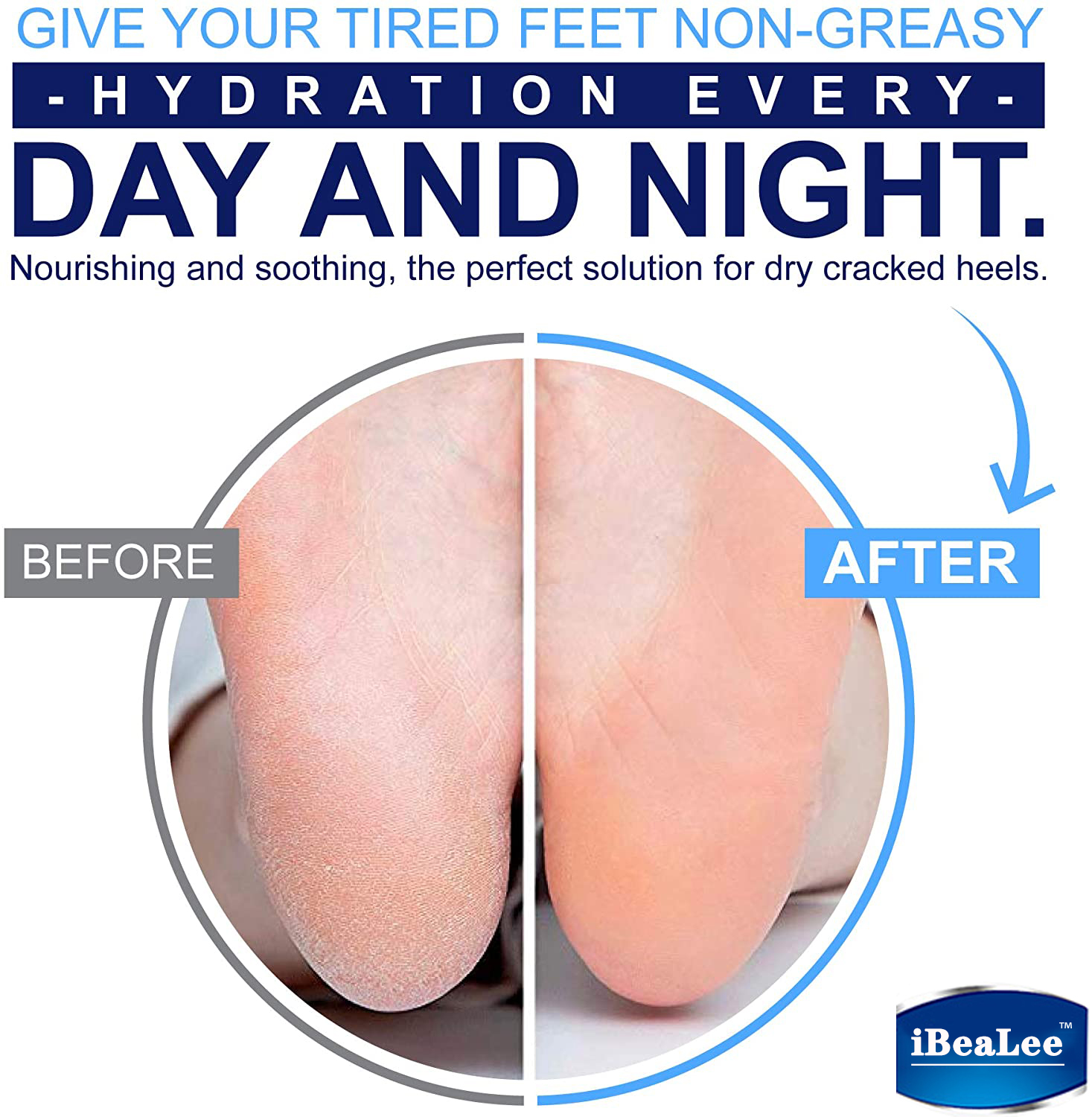iBeaLee Anti Crack Foot Cream Repair Cream Repair Heel Cracked Dry Calluses Dead Skin Feet Peel Mask Herbal Hand Peeling Removal Feet Care 35ml