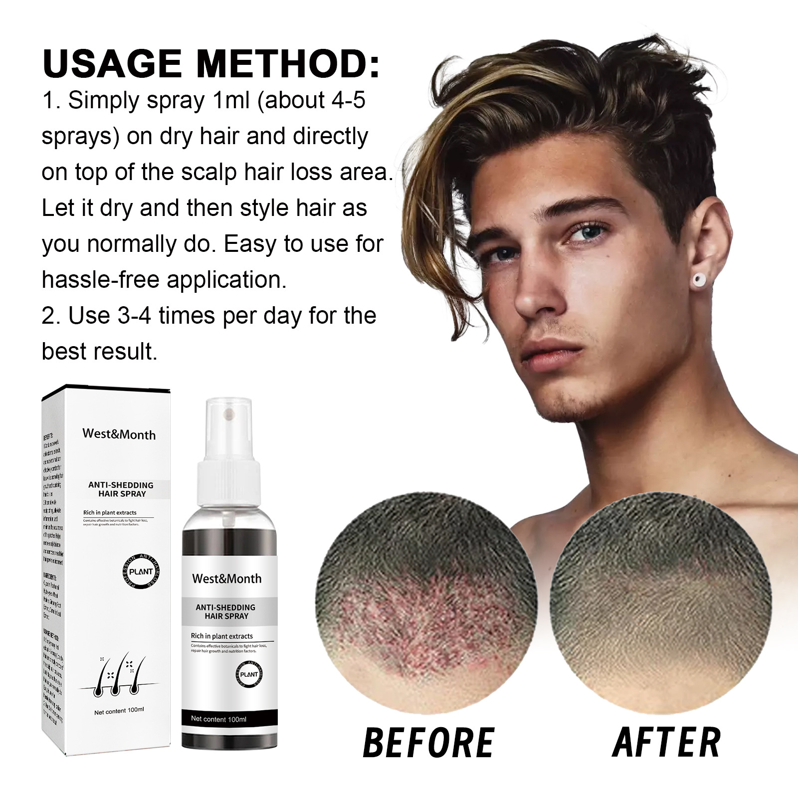 Anti Shedding Hair Spray Hair Growth Essence Hair Care Serums Improves Hairline Density Strengthens Hair Nourishes Hair Root Gel 100ml