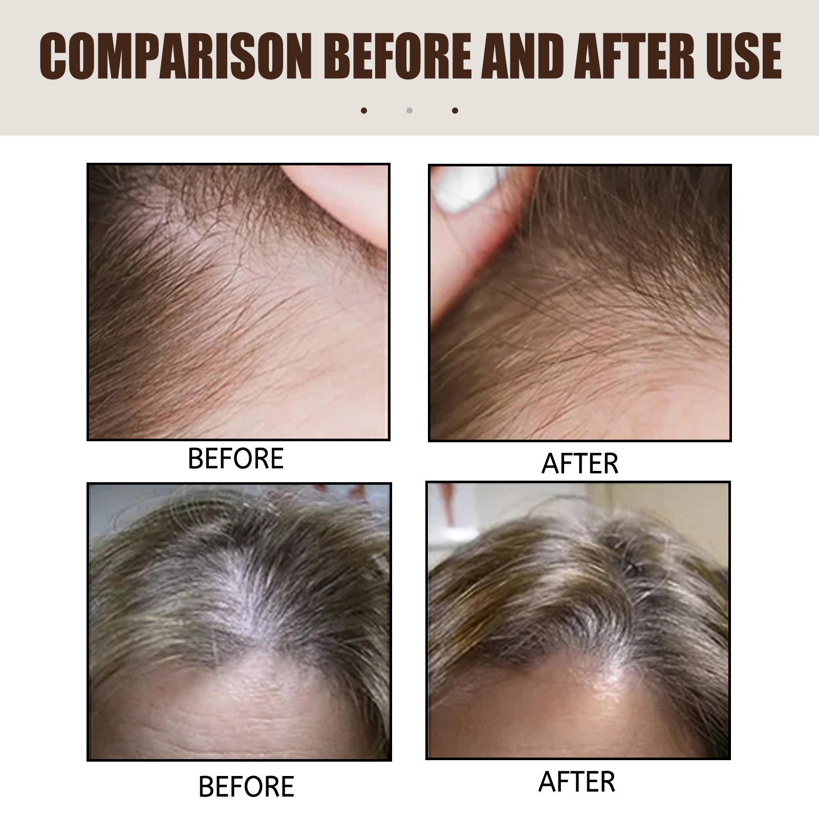 Hair Serum Dense Hair Essence Moisturizing Hair Repair Hair Root Thickening Hairline Strengthening Firming Hair Care