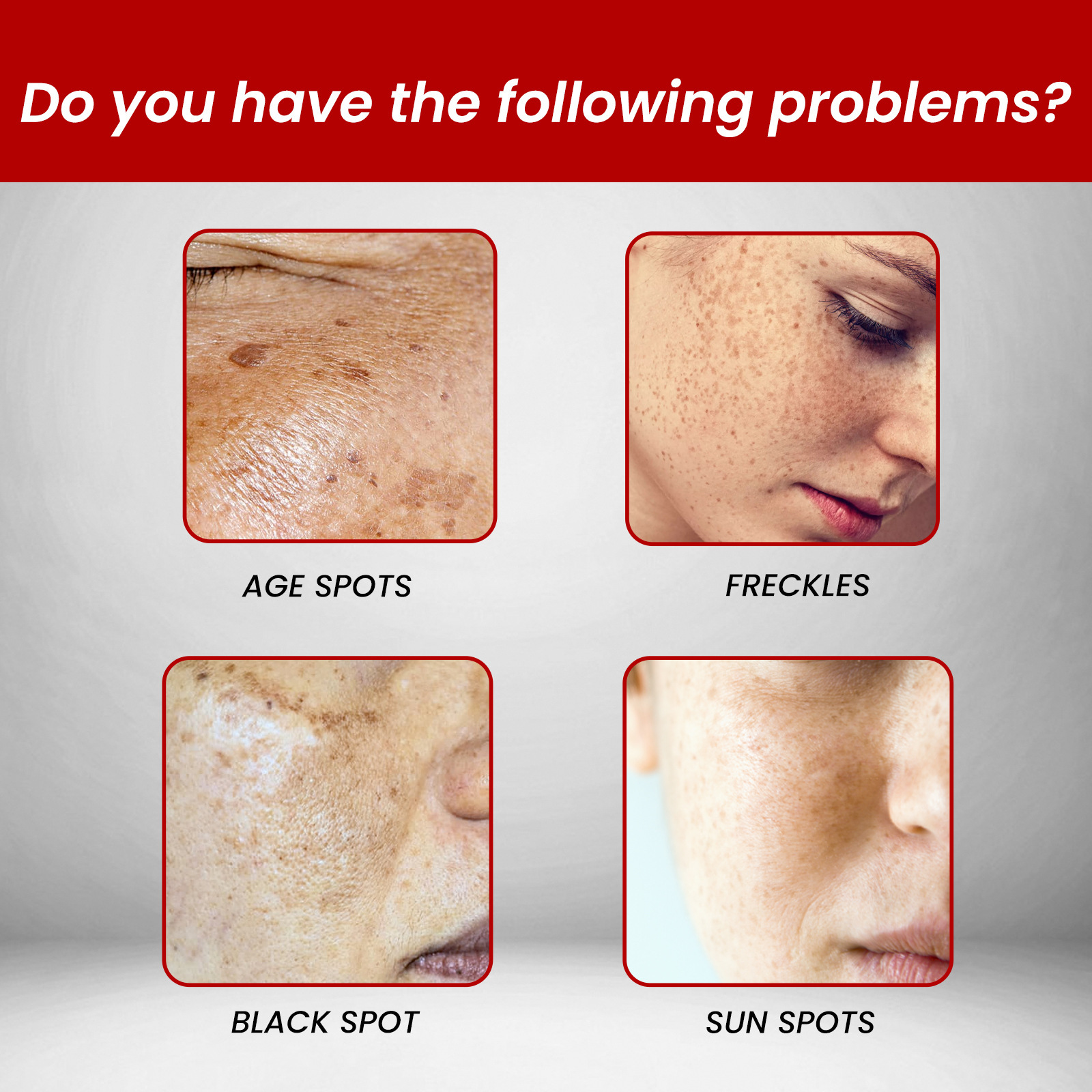 Whitening and Freckle Removing Cream Remove  Dark Spot Melanin Melasma Lighten Brighten Smooth Skin Care