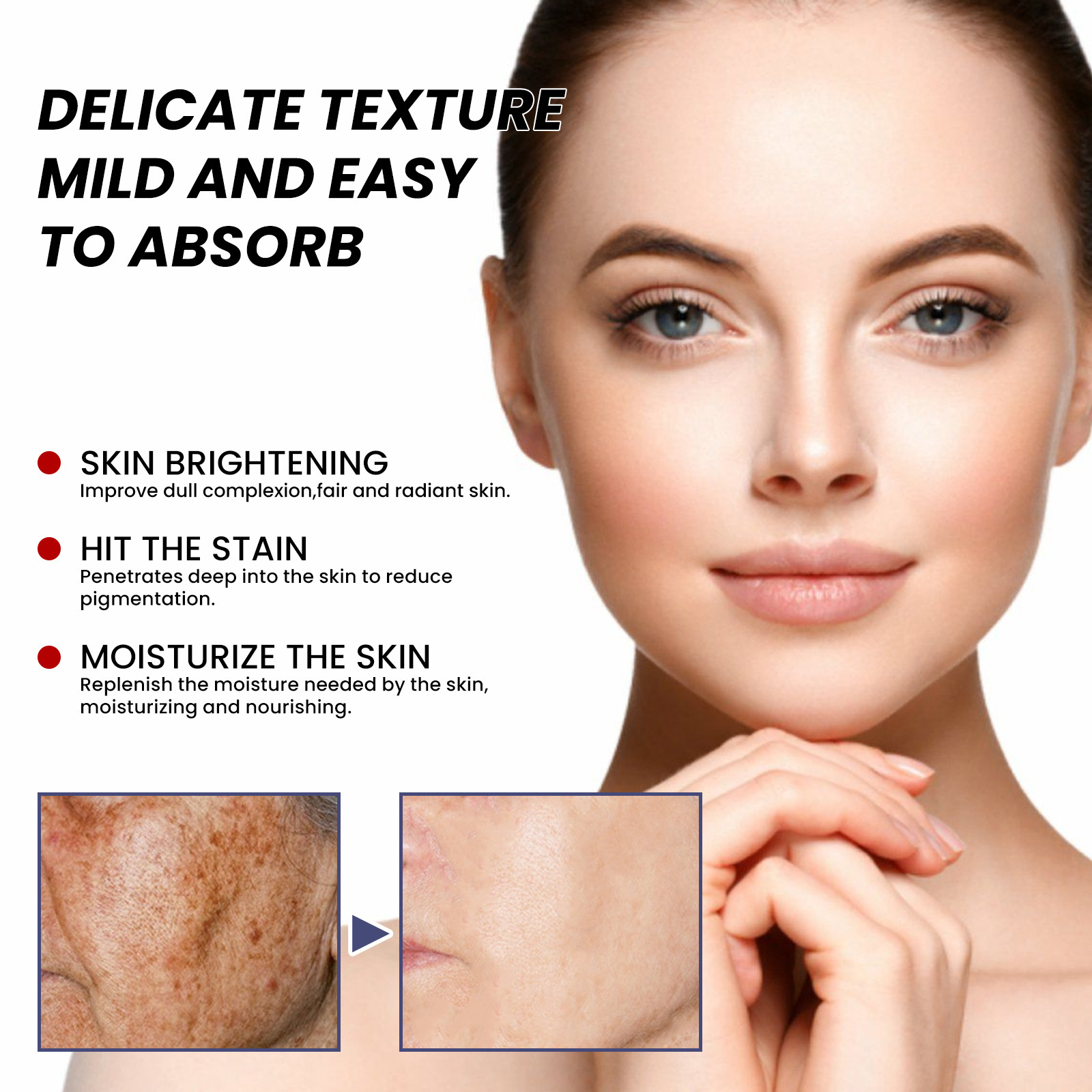 Whitening and Freckle Removing Cream Remove  Dark Spot Melanin Melasma Lighten Brighten Smooth Skin Care