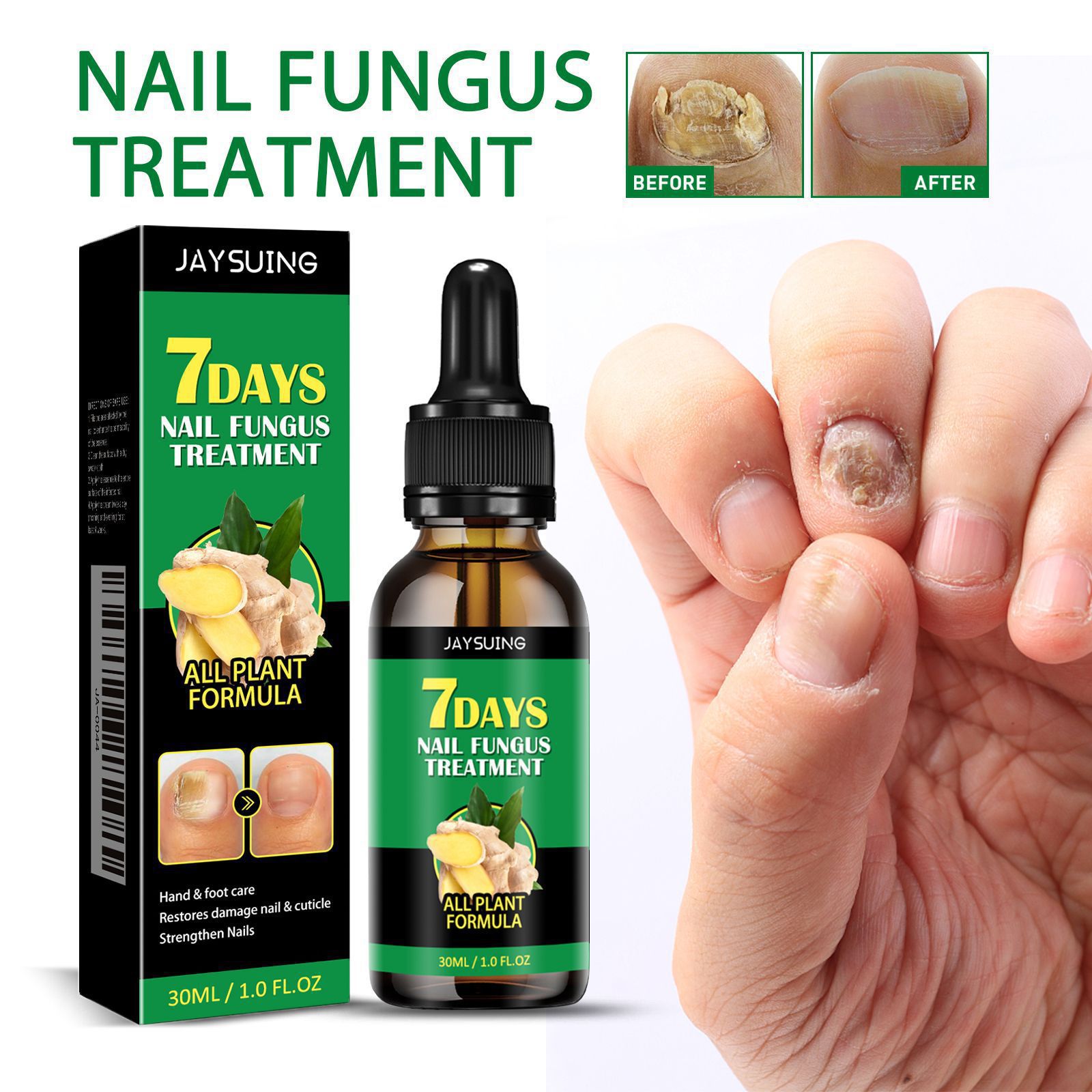 Ginger Nail Treatment For Smoothing Softening And Brightening Brittle Nails Daily Hand And Foot Home Care 15ml
