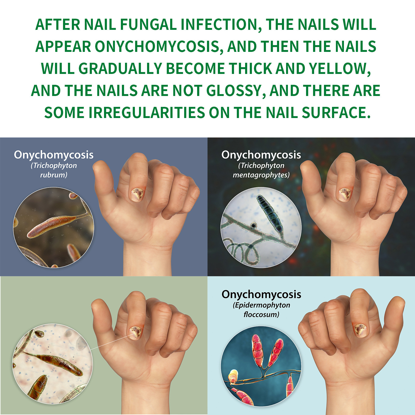 Ginger Nail Treatment For Smoothing Softening And Brightening Brittle Nails Daily Hand And Foot Home Care 15ml
