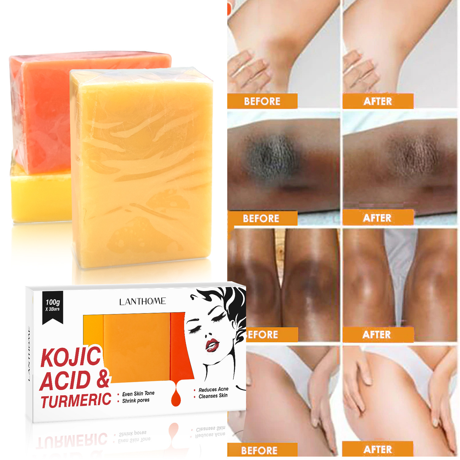 Kojic Acid Soap Set 3 Bars Deep Cleansing Exfoliating For Face And Body Daily Skincare Routine Natural Handmade 100g Each