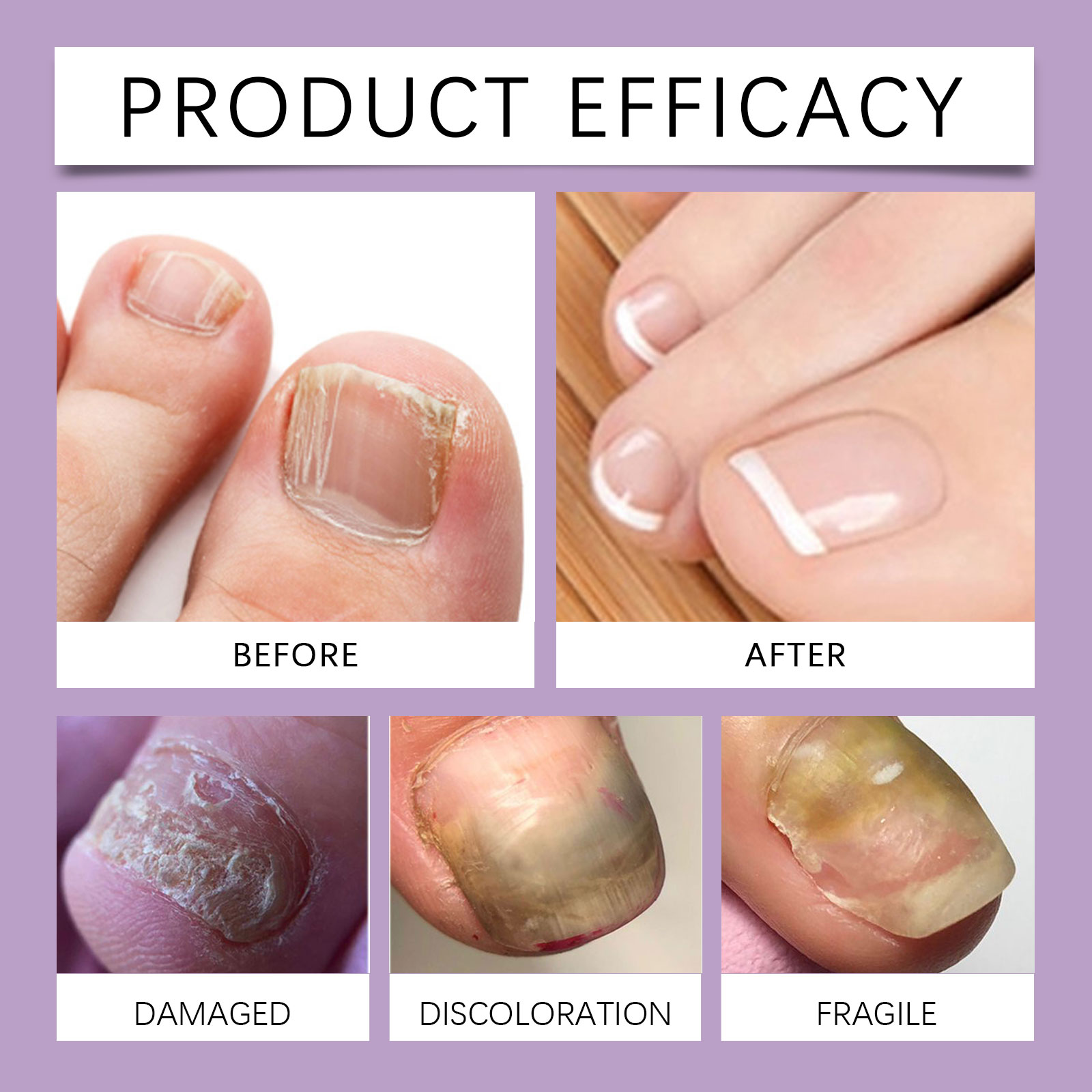 Nail Care Liquid Mild Moisturizing Nourishing Protective Soft Comfortable Glossy Convenient Daily Finger Toe Maintenance Solution
