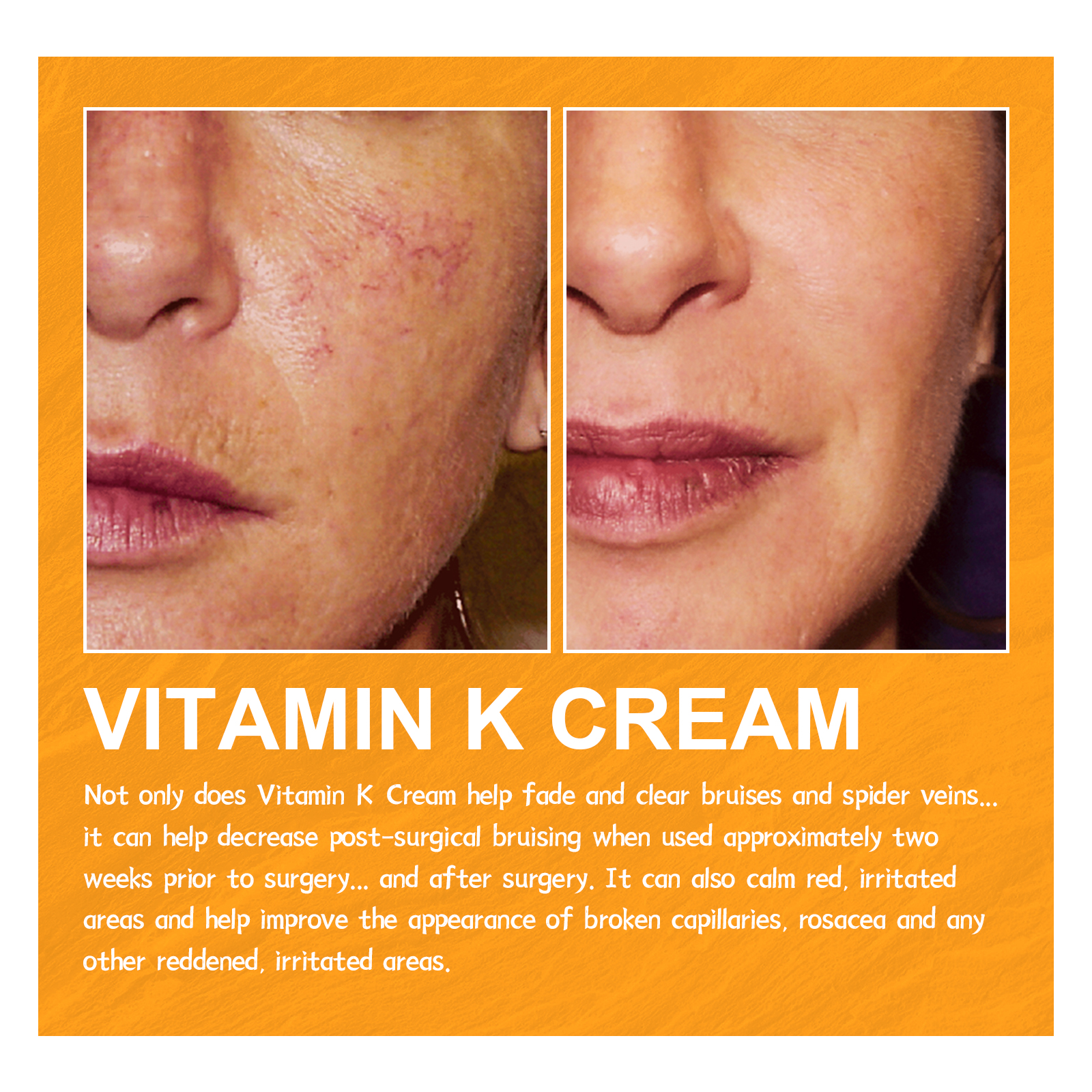 Body Cream Improves Dark Circles Discoloration Moisturising Skin Care