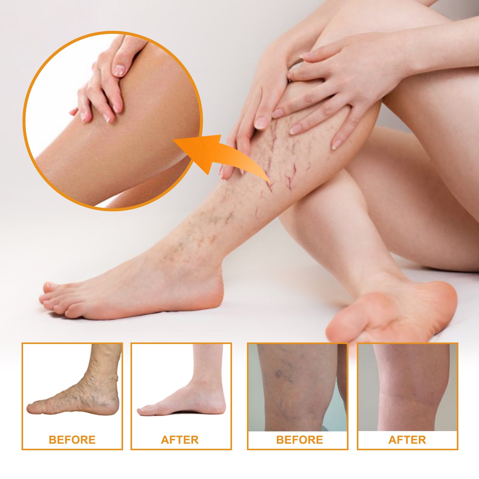 Body Cream Improves Dark Circles Discoloration Moisturising Skin Care