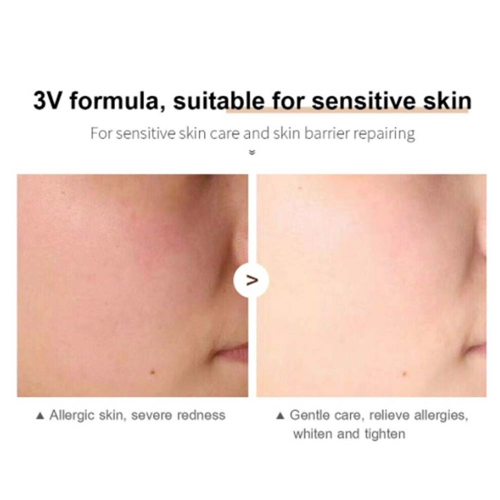 Whitening Cream Retinol Removes Melasma Acne Spots Pigment Dark Spots Pigment