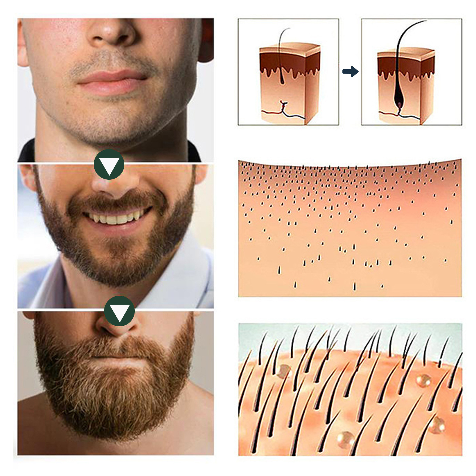 Ginger Hair Growth Serum 7 Days Prevent Hair Loss Essential Oil Fast Beard Hairline Growing Scalp Treatment for Women Men 30ml