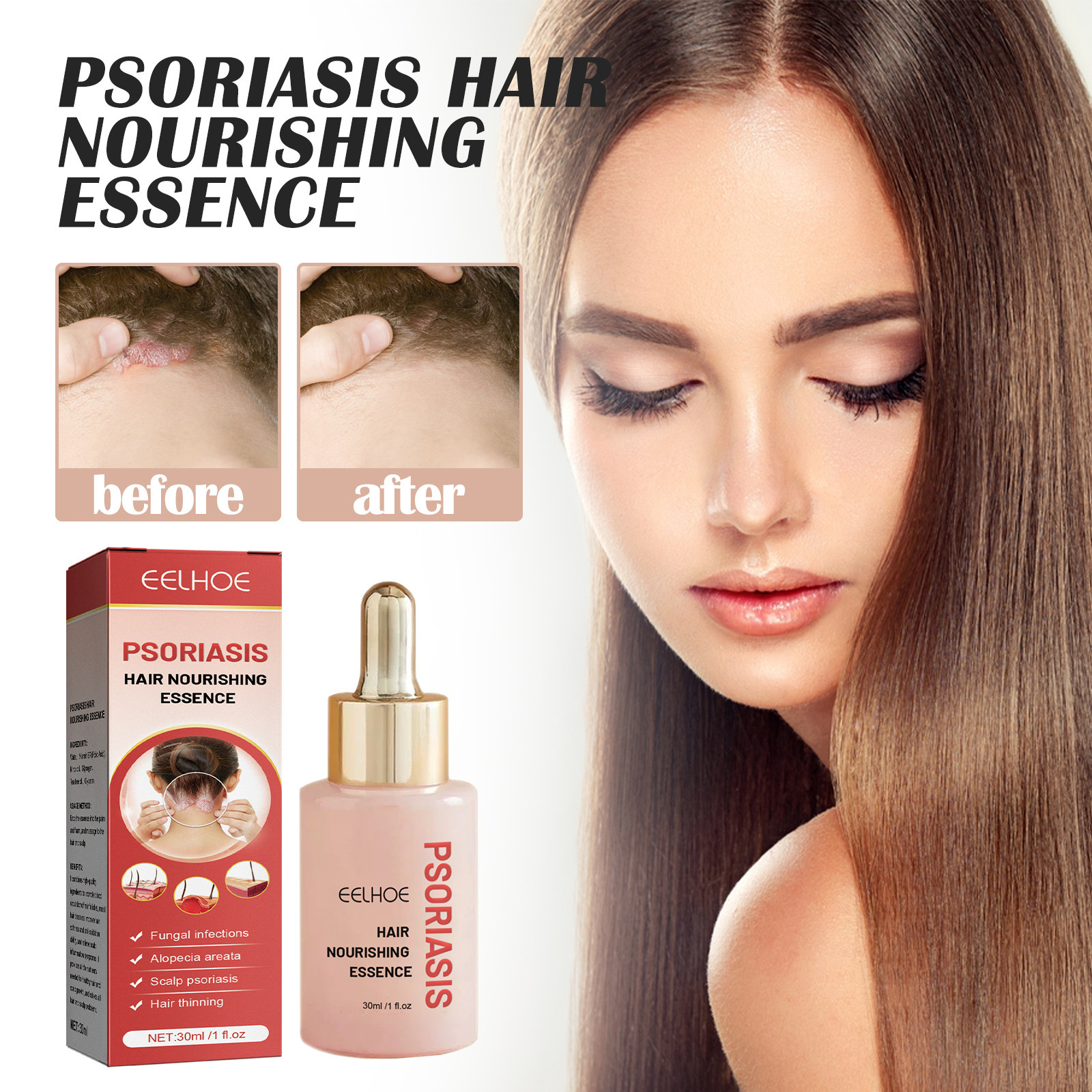 Hair Serum Psoriasis Dandruff Treatment for Scalp Oil Anti Itching Follicle Booster Stimulator Moisturizes Smoothing Nourishing
