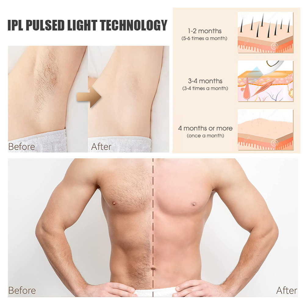 (White) Hair Remover IPL Permanent Laser Hair Removal Device for Women Men Painless Mini Epilator Equipment Machine Body Face Bikini Underarm Photoepilator Home Use