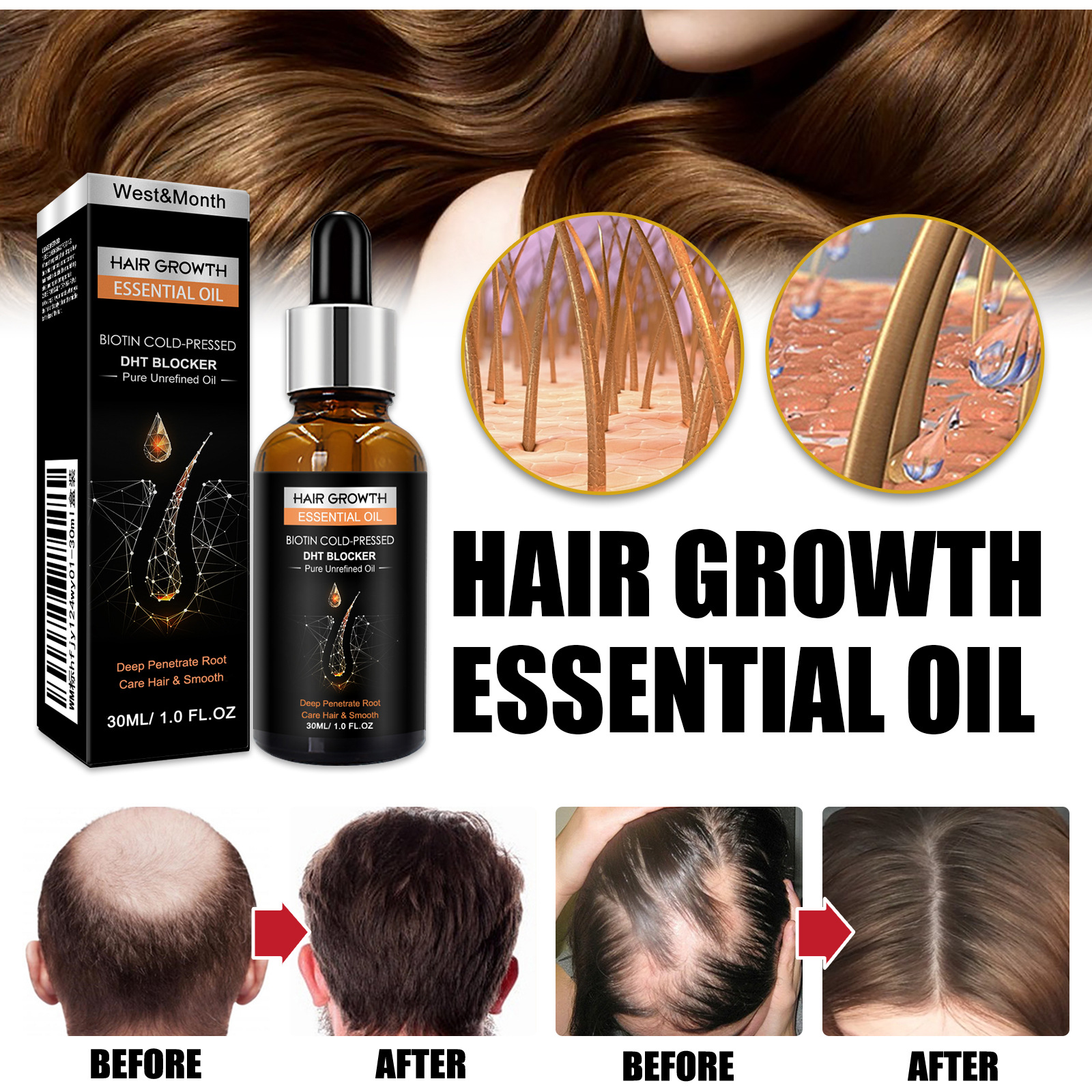 Hair Growth Essential Oil Biotin Cold-Pressed DHT Blocker Thick Hair Growth Shampoo Anti-Hair Loss Conditioner Repair Dry Hair Moisture Hair Essence 30ml