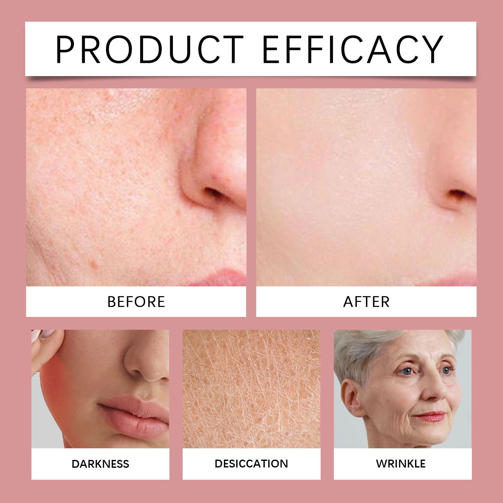 Skin Care Acne Patch Gentle Clean Lightweight Breathable Comfortable Facial Skin Blemish Daily Skin Care Sticker